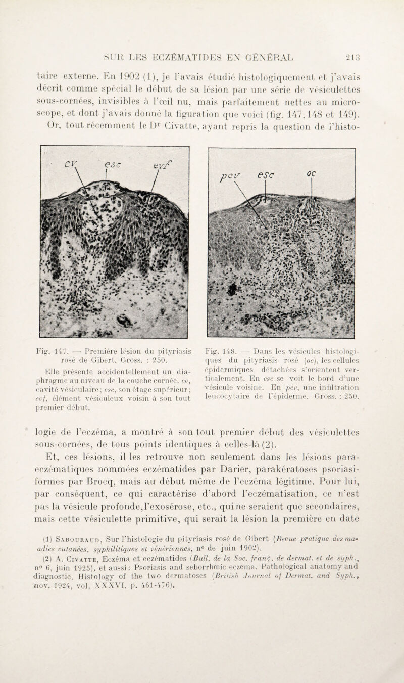 taire externe. En 1902 (1), je l'avais étudié histologiquement et j'avais décrit comme spécial le début de sa lésion par une série de vésiculettes sous-cornées, invisibles à l’œil nu, mais parfaitement nettes au micro¬ scope, et dont j’avais donné la figuration que voici (fig. 147,148 et 149). Or, tout récemment le Dr Civatte, ayant repris la question de i’histo- Fig, 147. —• Première lésion du pityriasis rosé de Gibert. Gross. : 250. Elle présente accidentellement un dia¬ phragme au niveau de la couche cornée, ce, cavité vésiculaire ; esc, son étage supérieur; evf, élément vésiculeux voisin à son tout premier début. Fig. 148. — Dans les vésicules histologi¬ ques du pityriasis rosé (oc), les cellules épidermiques détachées s’orientent ver¬ ticalement. En esc se voit le bord d’une vésicule voisine. En pcv, une infiltration leucocytaire de l’épiderme. Gross. : 250. logie de l’eczéma, a montré à son tout premier début des vésiculettes sous-cornées, de tous points identiques à celles-là (2). Et, ces lésions, il les retrouve non seulement dans les lésions para- eczématiques nommées eczématides par Darier, parakératoses psoriasi- formes par Brocq, mais au début même de l’eczéma légitime. Pour lui, par conséquent, ce qui caractérise d’abord l’eczématisation, ce n’est pas la vésicule profonde,l’exosérose, etc., qui ne seraient que secondaires, mais cette vésiculette primitive, qui serait la lésion la première en date (1) Sabouraud, Sur l’histologie du pityriasis rosé de Gibert [Revue pratique des ma- adies cutanées, syphilitiques et vénériennes, n° de juin 1902). (2) A. Civatte, Eczéma et eczématides [Bull, de la Soc. franç. de dermat. et de syph., n° 6, juin 1925), et aussi: Psoriasis and seborrhœic eczema. Pathological anatomy and diagnostic. Histology of the two dermatoses [British Journal of Dermat. and Syph., nov. 1924, vol. XXXYI, p. 461-476).