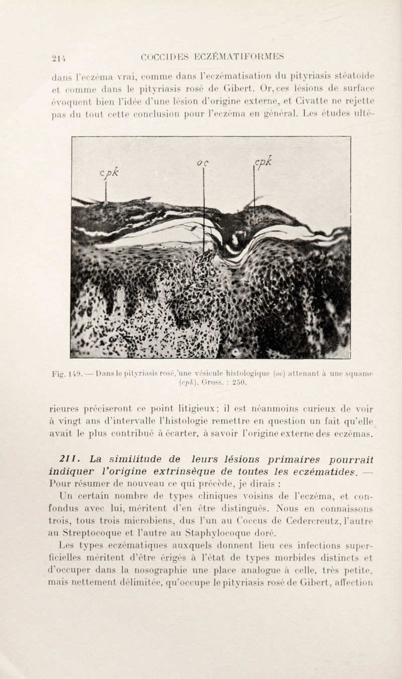 C ( >CC IDES EC Z É MAT IFOR MES dans l’eczéma vrai, comme dans l’eczématisation du pityriasis stéatoïde et comme dans le pityriasis rosé de Gibert. Or, ces lésions de surface évoquent bien l’idée d’une lésion d’origine externe, et Civatte ne rejette pas du tout cette conclusion pour l’eczéma en général. Les études ulté- Fig. 149. — Dans le pityriasis rosé,'une vésicule histologique (oc) attenant à une squame (cpk). Gross. : 250. rieures préciseront ce point litigieux; il est néanmoins curieux de voir à vingt ans d’intervalle l’histologie remettre en question un fait qu’elle avait le plus contribué à écarter, à savoir l’origine externe des eczémas. 211. La similitude de leurs lésions primaires pourrait indiquer Vorigine extrinsèque de toutes les eczématides. Pour résumer de nouveau ce qui précède, je dirais : Un certain nombre de types cliniques voisins de l’eczéma, et con¬ fondus avec lui, méritent d’en être distingués. Nous en connaissons trois, tous trois microbiens, dus l’un au Coccus de Cedercreutz, l’autre au Streptocoque et l’autre au Staphylocoque doré. Les types eczématiqoes auxquels donnent lieu ces infections super¬ ficielles méritent d’être érigés à l’état de types morbides distincts et d’occuper dans la nosographie une place analogue à celle, très petite, mais nettement délimitée, qu’occupe le pityriasis rosé de Gibert , affection