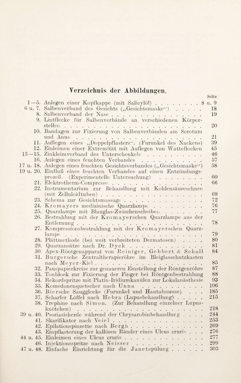 Verzeichnis der Abbildungen. Seite 1—5. Anlegen einer Kopf kappe (mit Salicylöl).8 u. 9 6 u. 7. Salbenverband des Gesichts („Gesichtsmaske“) . 18 8. Salbenverband der Nase. 19 9. Lintflecke für Salbenverbände an verschiedenen Körper¬ stellen . 20 10. Bandagen zur Fixierung von Salben verbänden am Sero tum und Anus. 21 11. Auflegen eines „Doppelpflasters“. (Furunkel des Nackens) 39 12. Einleimen einer Extremität mit Auflegen von Watteflocken 45 13 — 15. Zinkleimverband des Unterschenkels. 46 16. Anlegen eines feuchten Verbandes. 57 17 u. 18. Anlegen eines feuchten Gesichtsverbandes („Gesichtsmaske“) 58 19 u. 20. Einfluß eines feuchten Verbandes auf einen Entzündungs¬ prozeß. (Experimentelle Untersuchung) . 60 21. Elektrotherm-Compresse. 66 22. Instrumentarium zur Behandlung mit Kohlensäureschnee (mit Zelluloidtuben). 69 23. Schema zur Gesichtsmassage. 72 24. Kromayers medizinische Quarzlampe. 76 25. Quarzlampe mit Blauglas-Zwischenscheiben ....... 77 26. Bestrahlung mit der Kromayerschen Quarzlampe aus der Entfernung. 78 27. Kompressionsbestrahlung mit der Kromayerschen Quarz¬ lampe . 79 28. Plättmethode (bei weit verbreiteten Dermatosen) .... 80 29. Quarzansätze nach Dr. Dyck. 81 30. Apex-Röntgenapparat von Reiniger, Gebbert& Schall 84 31. Burgersche Zentraltherapieröhre im Bleiglasschutzkasten nach Meyer-Kiel. 85 32. Pauspapierkreise zur genaueren Einstellung der Röntgenröhre 87 33. Tonblock zur Fixierung der Finger bei Röntgenbestrahlung 88 34. Rekordspritze mit Platin-Iiidiumkanülen zur Lokalanästhesie 93 35. Komedonenquetscher nach Unna . 106 36. Bi ersehe Saugglocke (Furunkel und Hautabszesse) . . . 185 37. Scharfer Löffel nach Hebra (Lupusbehandlung).215 38. Trephine nach Simon. (Zur Behandlung einzelner Lupus¬ knötchen) .218 39 u. 40. Psoriasisherde während der Chrysarobinbehandlun g .... 244 4L Skarifikator nach Veiel.253 42. Epilationspinzette nach Bergh.269 43. Einpflasterung der kallösen Ränder eines Ulcus cruris ... 276 44 u. 45. Einleimen eines Ulcus cruris.277 46. Injektionsspritze nach Neisser .299 47 u. 48. Einfache Einrichtung für die Janetspülung.303