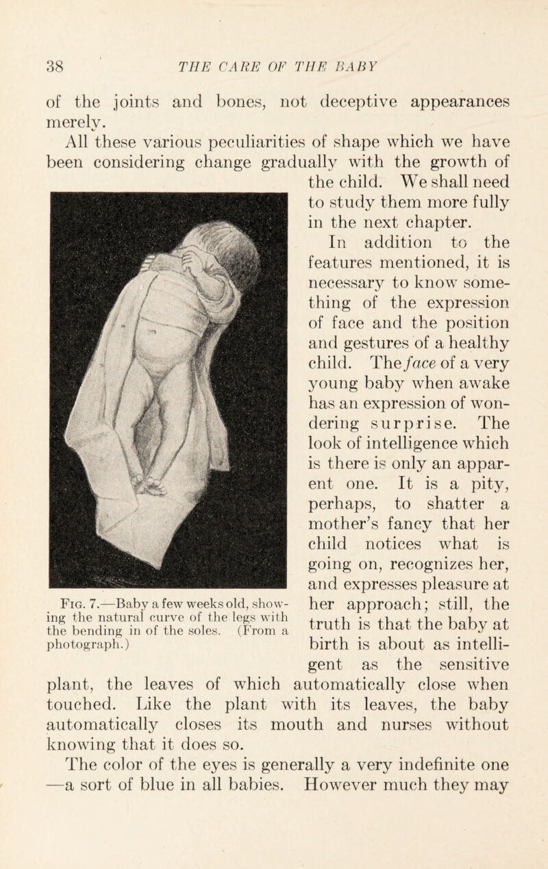 of the joints and bones, not deceptive appearances merely. All these various peculiarities of shape which we have been considering change gradually with the growth of the child. We shall need to study them more fully in the next chapter. In addition to the features mentioned, it is necessary to know some¬ thing of the expression of face and the position and gestures of a healthy child. Theface of a very young baby when awake has an expression of won¬ dering surprise. The look of intelligence which is there is only an appar¬ ent one. It is a pity, perhaps, to shatter a mother’s fancy that her child notices what is going on, recognizes her, and expresses pleasure at her approach; still, the truth is that the baby at birth is about as intelli¬ gent as the sensitive plant, the leaves of which automatically close when touched. Like the plant with its leaves, the baby automatically closes its mouth and nurses without knowing that it does so. The color of the eyes is generally a very indefinite one —a sort of blue in all babies. However much they may Fig. 7.—Baby a few weeks old, show¬ ing the natural curve of the legs with the bending in of the soles. (From a photograph.)