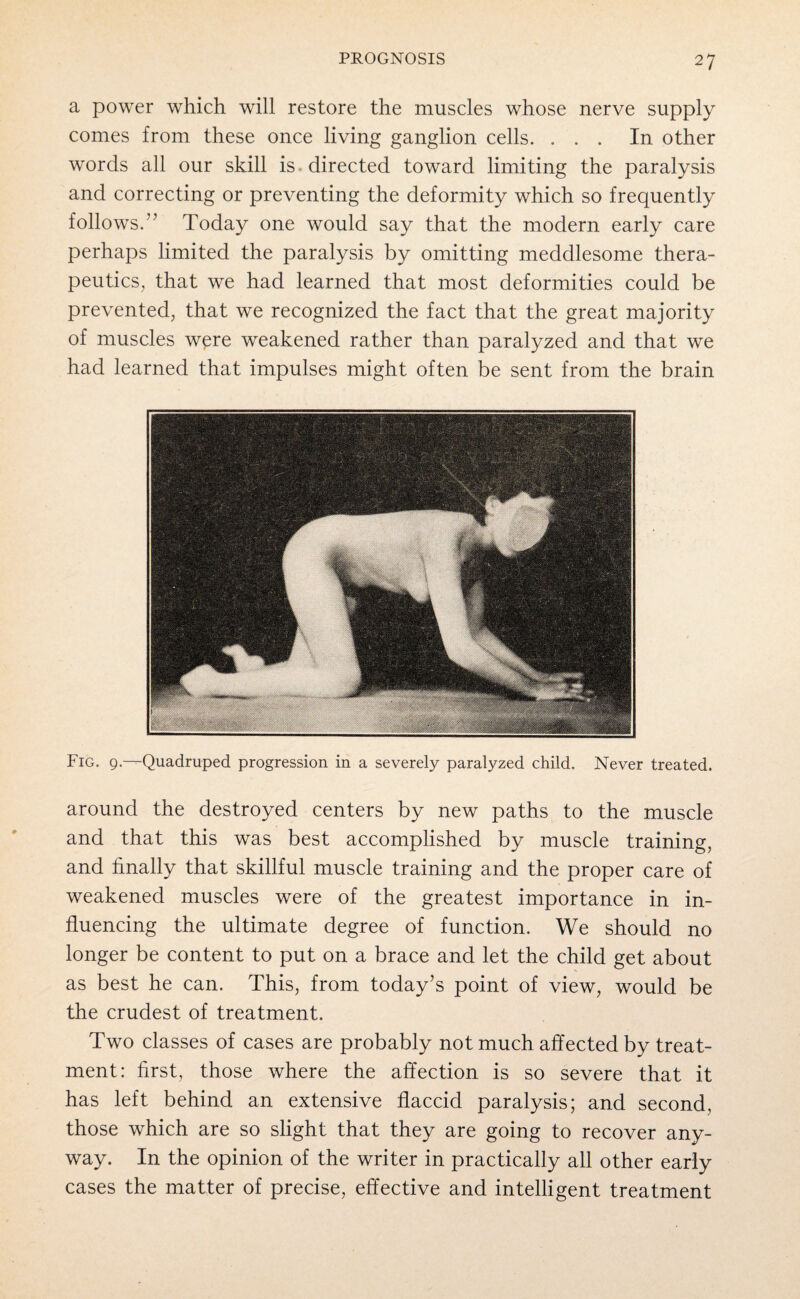 a power which will restore the muscles whose nerve supply comes from these once living ganglion cells. ... In other words all our skill is directed toward limiting the paralysis and correcting or preventing the deformity which so frequently follows.” Today one would say that the modern early care perhaps limited the paralysis by omitting meddlesome thera¬ peutics, that we had learned that most deformities could be prevented, that we recognized the fact that the great majority of muscles were weakened rather than paralyzed and that we had learned that impulses might often be sent from the brain Fig. 9—Quadruped progression in a severely paralyzed child. Never treated. around the destroyed centers by new paths to the muscle and that this was best accomplished by muscle training, and finally that skillful muscle training and the proper care of weakened muscles were of the greatest importance in in¬ fluencing the ultimate degree of function. We should no longer be content to put on a brace and let the child get about as best he can. This, from today’s point of view, would be the crudest of treatment. Two classes of cases are probably not much affected by treat¬ ment: first, those where the affection is so severe that it has left behind an extensive flaccid paralysis; and second, those which are so slight that they are going to recover any¬ way. In the opinion of the writer in practically all other early cases the matter of precise, effective and intelligent treatment