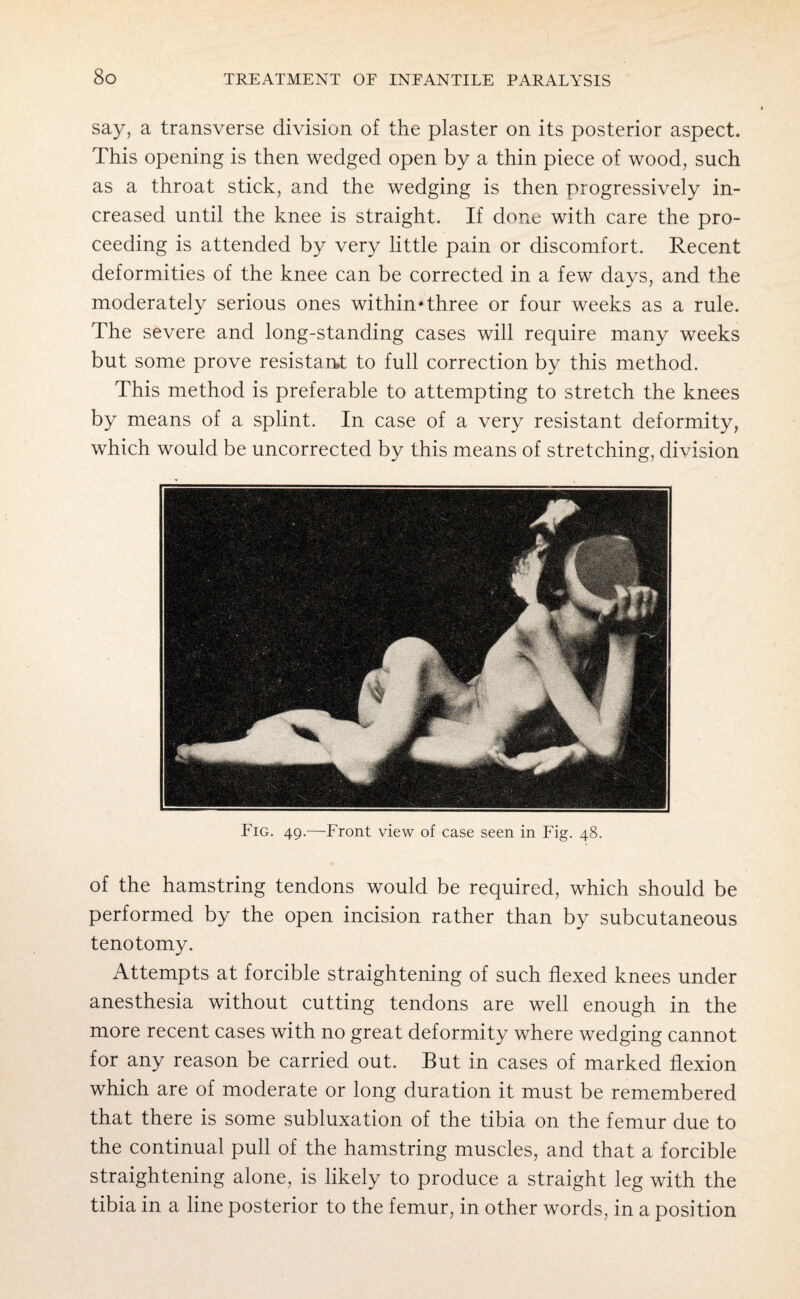 say, a transverse division of the plaster on its posterior aspect. This opening is then wedged open by a thin piece of wood, such as a throat stick, and the wedging is then progressively in¬ creased until the knee is straight. If done with care the pro¬ ceeding is attended by very little pain or discomfort. Recent deformities of the knee can be corrected in a few days, and the moderately serious ones within*three or four weeks as a rule. The severe and long-standing cases will require many weeks but some prove resistant to full correction by this method. This method is preferable to attempting to stretch the knees by means of a splint. In case of a very resistant deformity, which would be uncorrected by this means of stretching, division Fig. 49.—Front view of case seen in Fig. 48. of the hamstring tendons would be required, which should be performed by the open incision rather than by subcutaneous tenotomy. Attempts at forcible straightening of such flexed knees under anesthesia without cutting tendons are well enough in the more recent cases with no great deformity where wedging cannot for any reason be carried out. But in cases of marked flexion which are of moderate or long duration it must be remembered that there is some subluxation of the tibia on the femur due to the continual pull of the hamstring muscles, and that a forcible straightening alone, is likely to produce a straight leg with the tibia in a line posterior to the femur, in other words, in a position