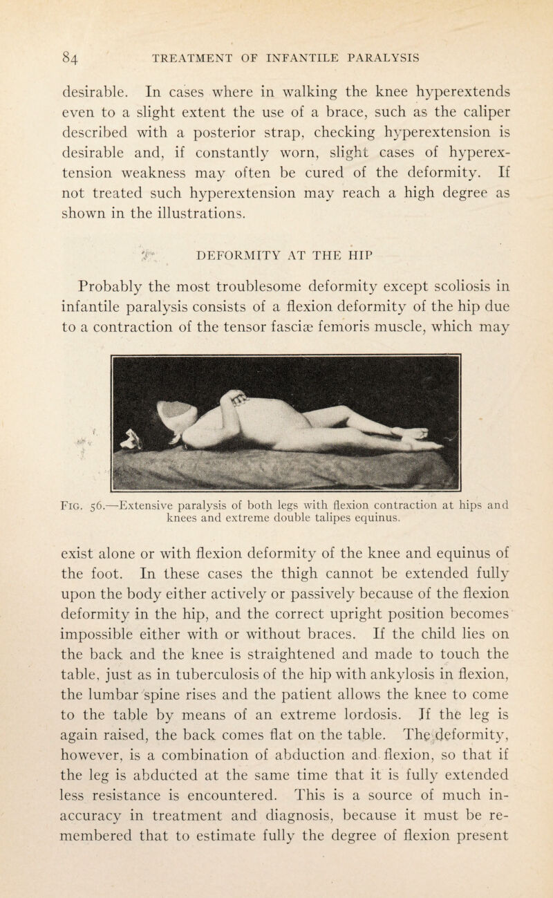 desirable. In cases where in walking the knee hyperextends even to a slight extent the use of a brace, such as the caliper described with a posterior strap, checking hyperextension is desirable and, if constantly worn, slight cases of hyperex¬ tension weakness may often be cured of the deformity. If not treated such hyperextension may reach a high degree as shown in the illustrations. DEFORMITY AT THE HIP Probably the most troublesome deformity except scoliosis in infantile paralysis consists of a flexion deformity of the hip due to a contraction of the tensor fasciae femoris muscle, which may Fig. 56.—Extensive paralysis of both legs with flexion contraction at hips and knees and extreme double talipes equinus. exist alone or with flexion deformity of the knee and equinus of the foot. In these cases the thigh cannot be extended fully upon the body either actively or passively because of the flexion deformity in the hip, and the correct upright position becomes impossible either with or without braces. If the child lies on the back and the knee is straightened and made to touch the table, just as in tuberculosis of the hip with ankylosis in flexion, the lumbar spine rises and the patient allows the knee to come to the table by means of an extreme lordosis. Jf the leg is again raised, the back comes flat on the table. The deformity, however, is a combination of abduction and flexion, so that if the leg is abducted at the same time that it is fully extended less resistance is encountered. This is a source of much in¬ accuracy in treatment and diagnosis, because it must be re¬ membered that to estimate fully the degree of flexion present