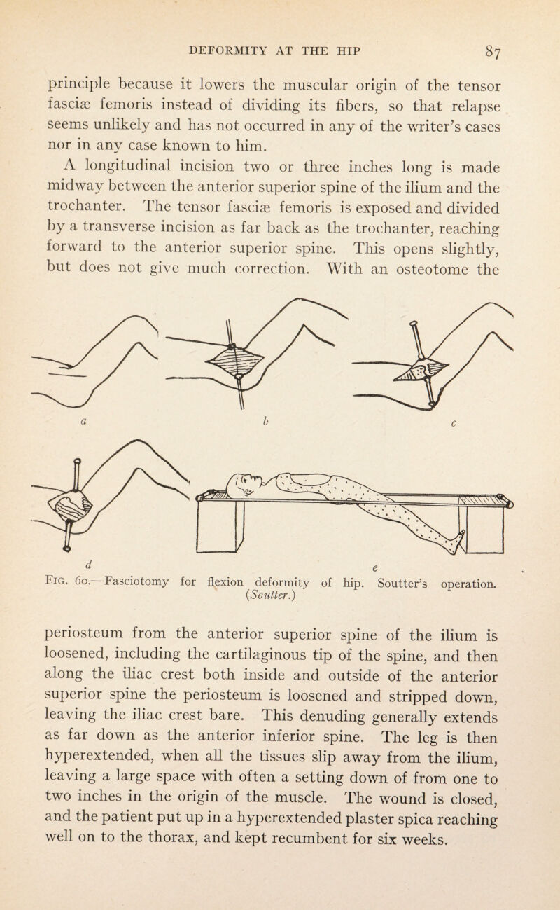 principle because it lowers the muscular origin of the tensor fasciae femoris instead of dividing its fibers, so that relapse seems unlikely and has not occurred in any of the writer’s cases nor in any case known to him. A longitudinal incision two or three inches long is made midway between the anterior superior spine of the ilium and the trochanter. The tensor fasciae femoris is exposed and divided by a transverse incision as far back as the trochanter, reaching forward to the anterior superior spine. This opens slightly, but does not give much correction. With an osteotome the periosteum from the anterior superior spine of the ilium is loosened, including the cartilaginous tip of the spine, and then along the iliac crest both inside and outside of the anterior superior spine the periosteum is loosened and stripped down, leaving the iliac crest bare. This denuding generally extends as far down as the anterior inferior spine. The leg is then hyperextended, when all the tissues slip away from the ilium, leaving a large space with often a setting down of from one to two inches in the origin of the muscle. The wound is closed, and the patient put up in a hyperextended plaster spica reaching well on to the thorax, and kept recumbent for six weeks.