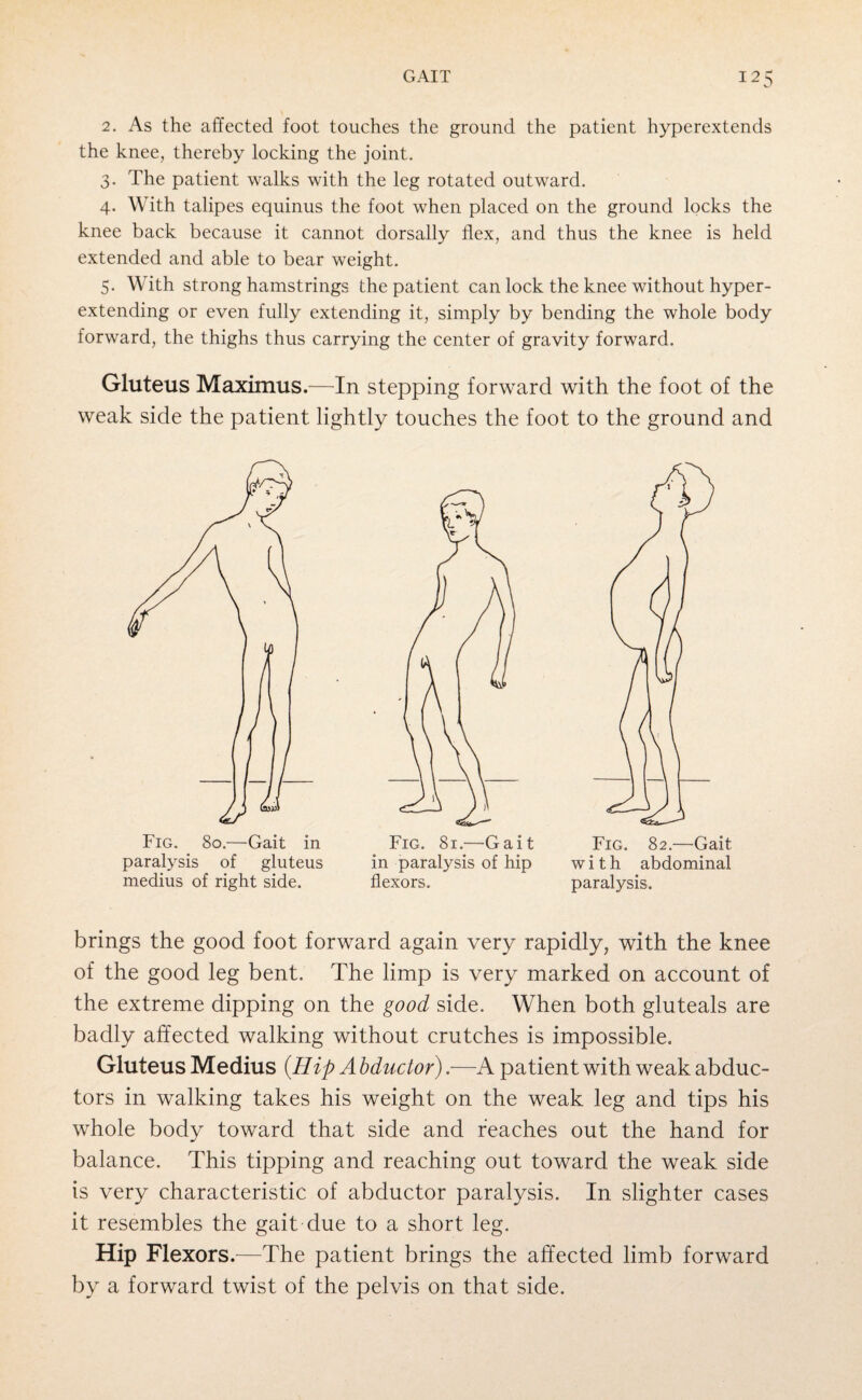 2. As the affected foot touches the ground the patient hyperextends the knee, thereby locking the joint. 3. The patient walks with the leg rotated outward. 4. With talipes equinus the foot when placed on the ground locks the knee back because it cannot dorsally flex, and thus the knee is held extended and able to bear weight. 5. With strong hamstrings the patient can lock the knee without hyper¬ extending or even fully extending it, simply by bending the whole body forward, the thighs thus carrying the center of gravity forward. Gluteus Maximus.—In stepping forward with the foot of the weak side the patient lightly touches the foot to the ground and paralysis of gluteus medius of right side. Fig. 81.-—Gait in paralysis of hip flexors. Fig. 82.—Gait with abdominal paralysis. brings the good foot forward again very rapidly, with the knee of the good leg bent. The limp is very marked on account of the extreme dipping on the good side. When both gluteals are badly affected walking without crutches is impossible. Gluteus Medius {Hip A bductor).—A patient with weak abduc¬ tors in walking takes his weight on the weak leg and tips his whole body toward that side and reaches out the hand for balance. This tipping and reaching out toward the weak side is very characteristic of abductor paralysis. In slighter cases it resembles the gait due to a short leg. Hip Flexors.—The patient brings the affected limb forward by a forward twist of the pelvis on that side.