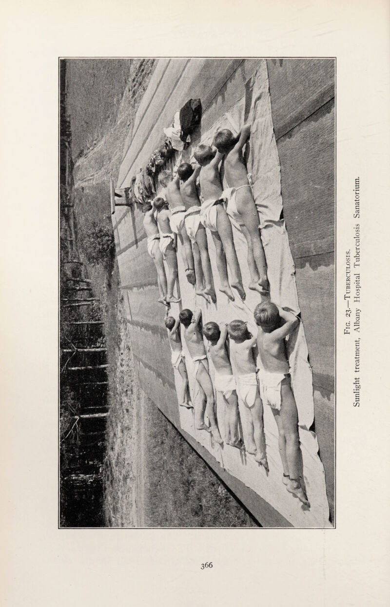 Fig. 23.—Tuberculosis. Sunlight treatment, Albany Hospital Tuberculosis Sanatorium.