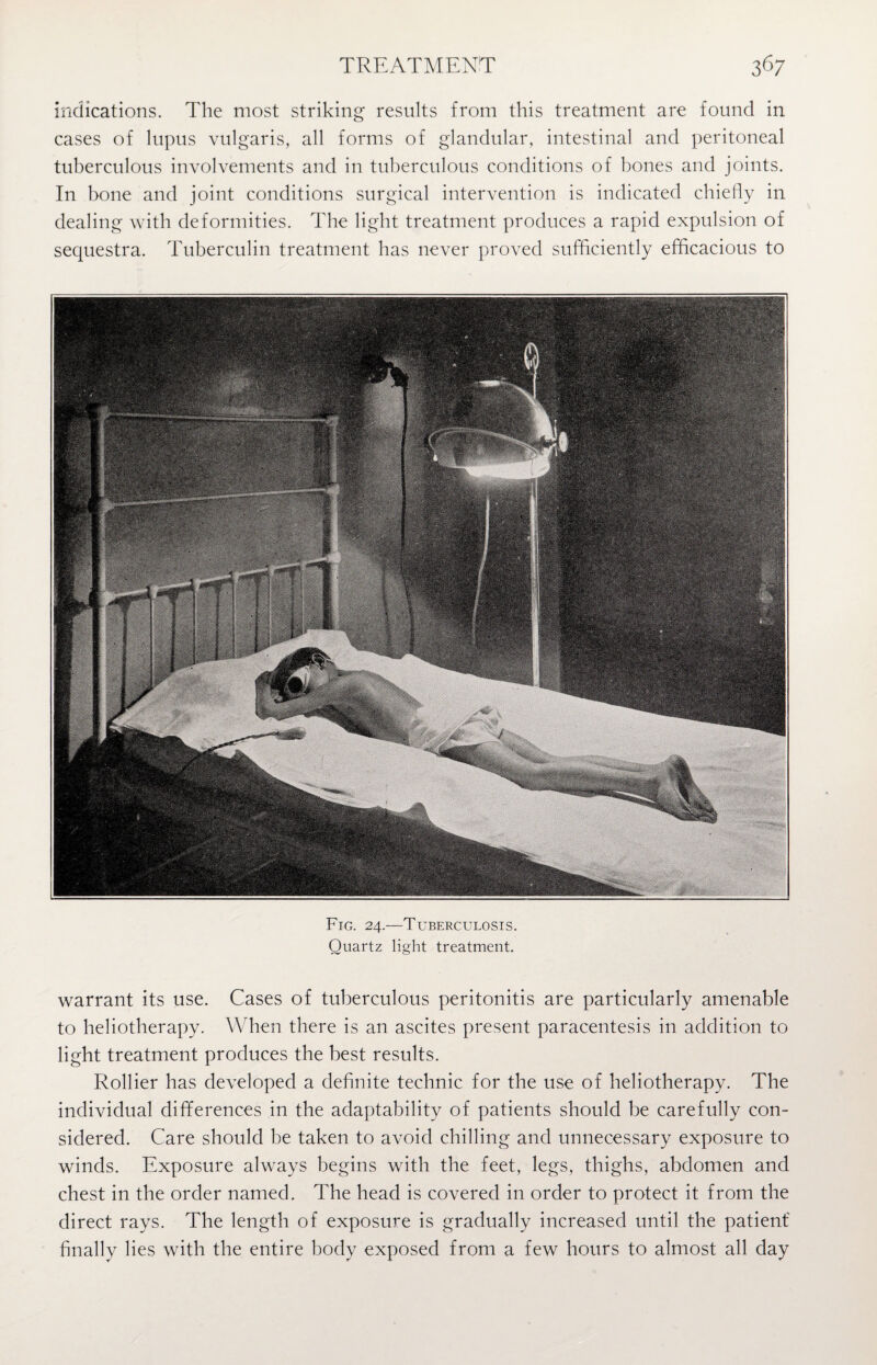 indications. The most striking results from this treatment are found in cases of lupus vulgaris, all forms of glandular, intestinal and peritoneal tuberculous involvements and in tuberculous conditions of bones and joints. In bone and joint conditions surgical intervention is indicated chiefly in dealing with deformities. The light treatment produces a rapid expulsion of sequestra. Tuberculin treatment has never proved sufficiently efficacious to Fig. 24.—Tuberculosis. Quartz light treatment. warrant its use. Cases of tuberculous peritonitis are particularly amenable to heliotherapy. When there is an ascites present paracentesis in addition to light treatment produces the best results. Rollier has developed a definite technic for the use of heliotherapy. The individual differences in the adaptability of patients should be carefully con¬ sidered. Care should be taken to avoid chilling and unnecessary exposure to winds. Exposure always begins with the feet, legs, thighs, abdomen and chest in the order named. The head is covered in order to protect it from the direct rays. The length of exposure is gradually increased until the patient' finally lies with the entire body exposed from a few hours to almost all day