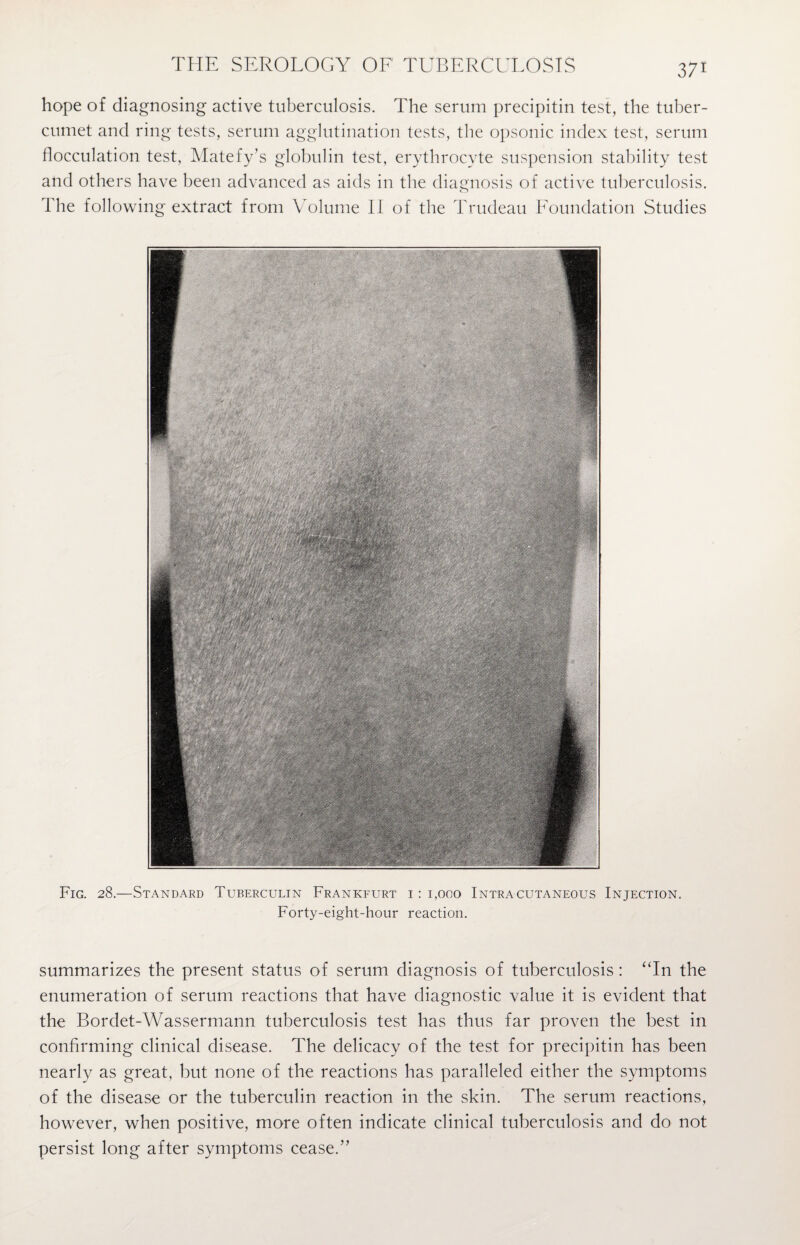 hope of diagnosing active tuberculosis. The serum precipitin test, the tuber- cumet and ring tests, serum agglutination tests, the opsonic index test, serum flocculation test, Matefy’s globulin test, erythrocyte suspension stability test and others have been advanced as aids in the diagnosis of active tuberculosis. The following extract from Volume II of the Trudeau Foundation Studies Fig. 28.—Standard Tuberculin Frankfurt i : 1,000 Intracutaneous Injection. Forty-eight-hour reaction. summarizes the present status of serum diagnosis of tuberculosis: “In the enumeration of serum reactions that have diagnostic value it is evident that the Bordet-Wassermann tuberculosis test has thus far proven the best in confirming clinical disease. The delicacy of the test for precipitin has been nearly as great, but none of the reactions has paralleled either the symptoms of the disease or the tuberculin reaction in the skin. The serum reactions, however, when positive, more often indicate clinical tuberculosis and do not persist long after symptoms cease.”