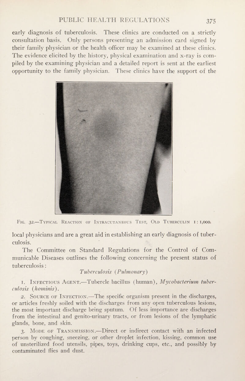 early diagnosis of tuberculosis. These clinics are conducted on a strictly consultation basis. Only persons presenting an admission card signed by their family physician or the health officer may be examined at these clinics. The evidence elicited by the history, physical examination and x-ray is com¬ piled by the examining physician and a detailed report is sent at the earliest opportunity to the family physician. These clinics have the support of the Fig. 32.—Typical Reaction of Intracutaneous Test, Old Tuberculin i : 1,000. local physicians and are a great aid in establishing an early diagnosis of tuber¬ culosis. The Committee on Standard Regulations for the Control of Com¬ municable Diseases outlines the following concerning the present status of tuberculosis: Tuberculosis (Pulmonary) 1. Infectious Agent.—Tubercle bacillus (human), Mycobacterium tuber¬ culosis ( h ominis ). 2. Source of Infection.—The specific organism present in the discharges, or articles freshly soiled with the discharges from any open tuberculous lesions, the most important discharge being sputum. Of less importance are discharges from the intestinal and genito-urinary tracts, or from lesions of the lymphatic glands, bone, and skin. 3. Mode of Transmission.—Direct or indirect contact with an infected person by coughing, sneezing, or other droplet infection, kissing, common use of unsterilized food utensils, pipes, toys, drinking cups, etc., and possibly by contaminated flies and dust.