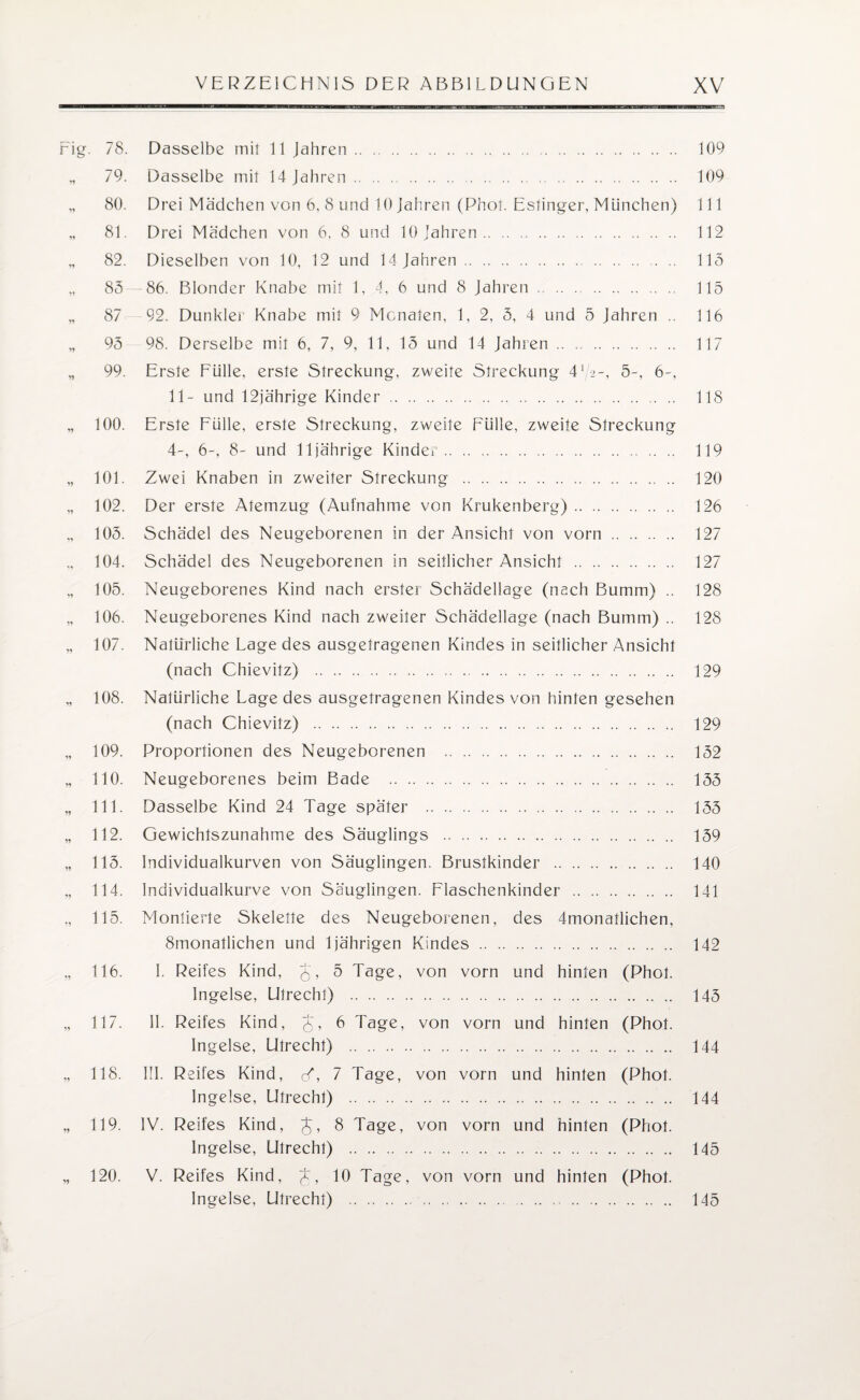 rig. 78. Dasselbe mit 11 Jahren. .. 109 „ 79. Dasselbe mit 14 Jahren.. .. . . . 109 „ 80. Drei Mädchen von 6, 8 und 10 Jahren (Phot. Estinger, München) 111 „ 81. Drei Mädchen von 6, 8 und 10 Jahren. 112 „ 82. Dieselben von 10, 12 und 14 Jahren.. . 115 „ 85 86. Blonder Knabe mit 1, 4, 6 und 8 Jahren. 115 „ 87 92. Dunkler Knabe mit 9 Monaten, 1, 2, 5, 4 und 5 Jahren .. 116 „ 95 98. Derselbe mit 6, 7, 9, 11, 15 und 14 Jahren .. .. .. 117 „ 99. Erste Fülle, erste Streckung, zweite Streckung 4l/-2-, 5-, 6-, 11- und 12jährige Kinder. 118 „ 100. Erste Fülle, erste Streckung, zweite Fülle, zweite Streckung 4-, 6-, 8- und 11jährige Kinder. .. .. .. .. .. 119 „ 101. Zwei Knaben in zweiter Streckung .... .. 120 „ 102. Der erste Atemzug (Aufnahme von Krukenberg). 126 „ 105. Schädel des Neugeborenen in der Ansicht von vorn .. 127 „ 104. Schädel des Neugeborenen in seitlicher Ansicht . 127 „ 105. Neugeborenes Kind nach erster Schädellage (nach Bumm) .. 128 „ 106. Neugeborenes Kind nach zweiter Schädellage (nach Bumm) .. 128 „ 107. Natürliche Lage des ausgetragenen Kindes in seitlicher Ansicht (nach Chievitz) . .. .. . 129 „ 108. Natürliche Lage des ausgetragenen Kindes von hinten gesehen (nach Chievitz) . 129 „ 109. Proportionen des Neugeborenen .. .. .. .. 152 „ 110. Neugeborenes beim Bade . 155 „ 111. Dasselbe Kind 24 Tage später . 155 „ 112. Gewichtszunahme des Säuglings . 159 „ 115. Individualkurven von Säuglingen. Brustkinder . 140 „ 114. Individualkurve von Säuglingen. Flaschenkinder . 141 ., 115. Montierte Skelette des Neugeborenen, des 4monatlichen, 8monatlichen und 1jährigen Kindes. 142 „ 116. I. Reifes Kind, J, 5 Tage, von vorn und hinten (Phot. Ingelse, Utrecht) . 145 „ 117. II. Reifes Kind, J, 6 Tage, von vorn und hinten (Phot. Ingelse, Utrecht) . 144 „ 118. III. Reifes Kind, <S, 1 Tage, von vorn und hinten (Phot. Ingelse, Utrecht) . 144 „ 119. IV. Reifes Kind, J, 8 Tage, von vorn und hinten (Phot. Ingelse, Utrecht) . 145 „ 120. V. Reifes Kind, J, 10 Tage, von vorn und hinten (Phot. Ingelse, Utrecht) . 145