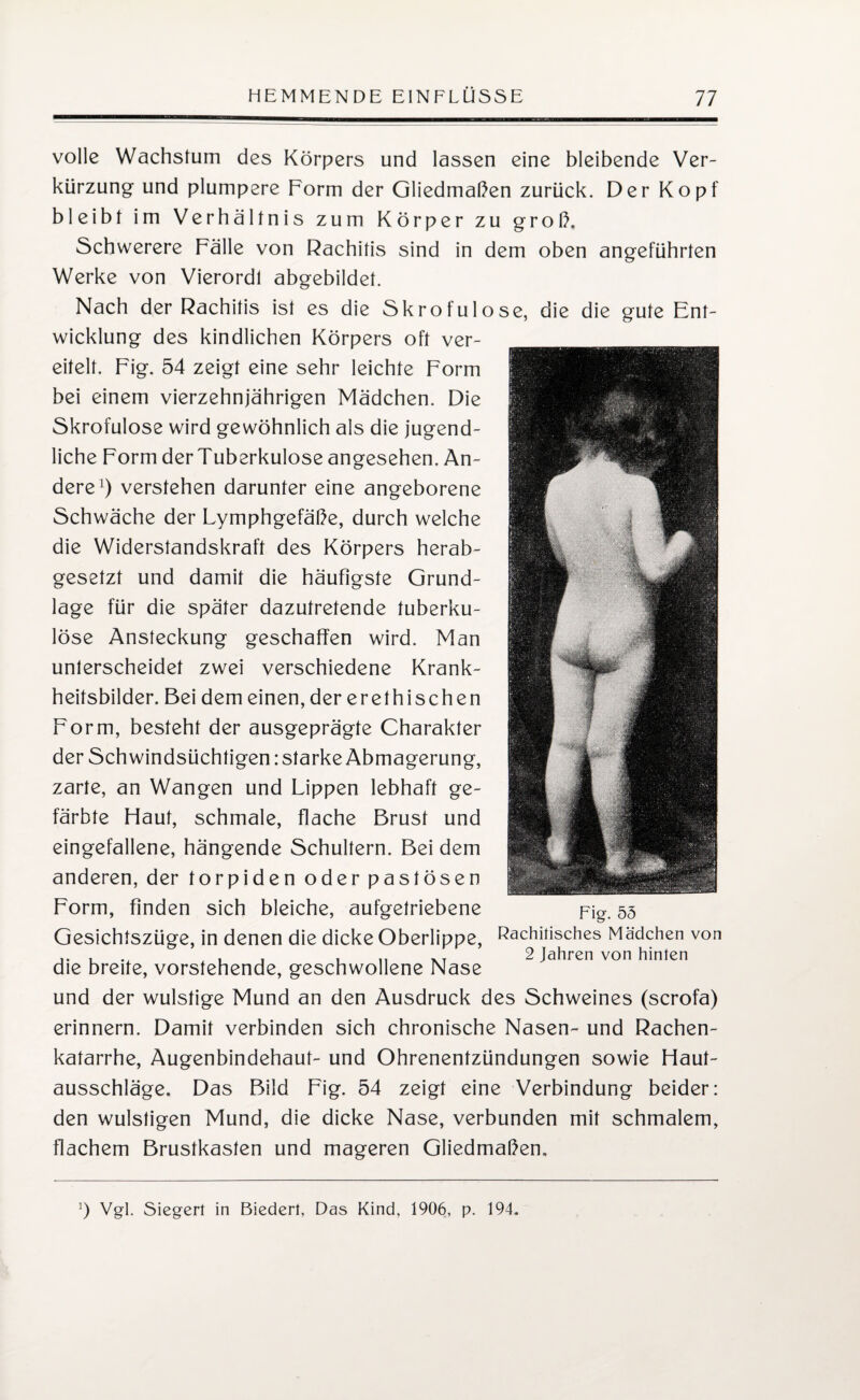 volle Wachstum des Körpers und lassen eine bleibende Ver¬ kürzung und plumpere Form der Gliedmaßen zurück. Der Kopf bleibt im Verhältnis zum Körper zu groß. Schwerere Fälle von Rachitis sind in dem oben angeführten Werke von Vierordl abgebildet. Nach der Rachitis ist es die Skrofulöse, die die gute Ent¬ wicklung des kindlichen Körpers oft ver¬ eitelt. Fig. 54 zeigt eine sehr leichte Form bei einem vierzehnjährigen Mädchen. Die Skrofulöse wird gewöhnlich als die jugend¬ liche Form der Tuberkulose angesehen. An¬ dere1) verstehen darunter eine angeborene Schwäche der Lymphgefäße, durch welche die Widerstandskraft des Körpers herab¬ gesetzt und damit die häufigste Grund¬ lage für die später dazutretende tuberku¬ löse Ansteckung geschaffen wird. Man unterscheidet zwei verschiedene Krank¬ heitsbilder. Bei dem einen, der erethischen Form, besteht der ausgeprägte Charakter der Schwindsüchtigen: starke Abmagerung, zarte, an Wangen und Lippen lebhaft ge¬ färbte Flaut, schmale, flache Brust und eingefallene, hängende Schultern. Bei dem anderen, der torpiden oder pastösen Form, finden sich bleiche, aufgetriebene Fig. 55 Gesichtszüge, in denen die dicke Oberlippe, Rachitisches Mädchen von 2 Jahren von hinten die breite, vorstehende, geschwollene Nase und der wulstige Mund an den Ausdruck des Schweines (scrofa) erinnern. Damit verbinden sich chronische Nasen- und Rachen¬ katarrhe, Augenbindehaut- und Ohrenentzündungen sowie Flaut¬ ausschläge. Das Bild Fig. 54 zeigt eine Verbindung beider: den wulstigen Mund, die dicke Nase, verbunden mit schmalem, flachem Brustkasten und mageren Gliedmaßen. ö Vgl. Sieger! in Biedert, Das Kind, 1906, p. 194.