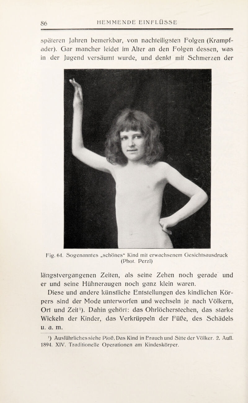 späteren Jahren bemerkbar, von nachteiligsten Folgen (Krampf¬ ader). Gar mancher leidet im Alter an den Folgen dessen, was in der Jugend versäumt wurde, und denkt mit Schmerzen der Fig. 64. Sogenanntes „schönes“ Kind mit erwachsenem Gesichtsausdruck (Phot. Perzl) längstvergangenen Zeiten, als seine Zehen noch gerade und er und seine Hühneraugen noch ganz klein waren. Diese und andere künstliche Entstellungen des kindlichen Kör¬ pers sind der Mode unterworfen und wechseln je nach Völkern, Ort und Zeit1). Dahin gehört: das Ohrlöcherstechen, das starke Wickeln der Kinder, das Verkrüppeln der Füße, des Schädels u. a. m. J) Ausführliches siehe PioÜ, Das Kind inFrauchund Sitte der Völker. 2. Aufl. 1894. XIV. Traditionelle Operationen am Kindeskörper.