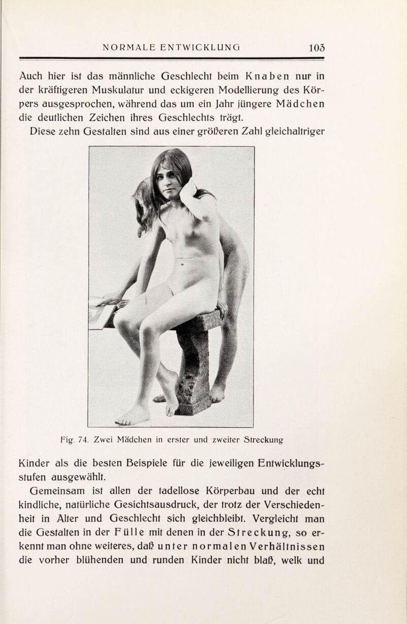 Auch hier ist das männliche Geschlecht beim Knaben nur in der kräftigeren Muskulatur und eckigeren Modellierung des Kör¬ pers ausgesprochen, während das um ein Jahr jüngere Mädchen die deutlichen Zeichen ihres Geschlechts trägt. Diese zehn Gestalten sind aus einer größeren Zahl gleichaltriger Fig. 74. Zwei Mädchen in erster und zweiter Streckung Kinder als die besten Beispiele für die jeweiligen Entwicklungs¬ stufen ausgewählt. Gemeinsam ist allen der tadellose Körperbau und der echt kindliche, natürliche Gesichtsausdruck, der trotz der Verschieden¬ heit in Alter und Geschlecht sich gleichbleibt. Vergleicht man die Gestalten in der Fülle mit denen in der Streckung, so er¬ kennt man ohne weiteres, daß unter normalen Verhältnissen die vorher blühenden und runden Kinder nicht blaß, welk und