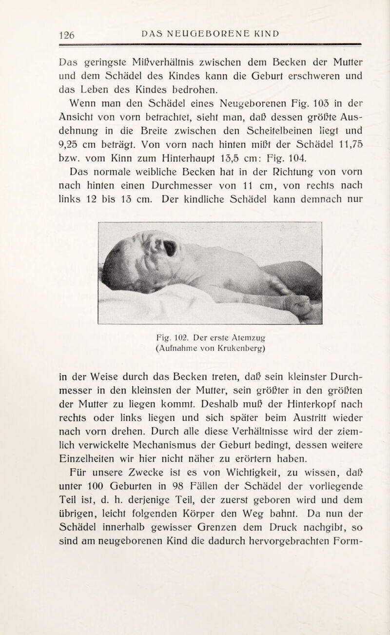 Das geringste Mißverhältnis zwischen dem Becken der Mutter und dem Schädel des Kindes kann die Geburt erschweren und das Leben des Kindes bedrohen. Wenn man den Schädel eines Neugeborenen Fig. 105 in der Ansicht von vorn betrachtet, sieht man, daß dessen größte Aus¬ dehnung in die Breite zwischen den Scheitelbeinen liegt und 9,25 cm beträgt. Von vorn nach hinten mißt der Schädel 11,75 bzw. vom Kinn zum Hinterhaupt 15,5 cm: Fig. 104. Das normale weibliche Becken hat in der Dichtung von vorn nach hinten einen Durchmesser von 11 cm, von rechts nach links 12 bis 15 cm. Der kindliche Schädel kann demnach nur Fig. 102. Der erste Atemzug (Aufnahme von Krukenberg) in der Weise durch das Becken treten, daß sein kleinster Durch¬ messer in den kleinsten der Mutter, sein größter in den größten der Mutter zu liegen kommt. Deshalb muß der Hinterkopf nach rechts oder links liegen und sich später beim Austritt wieder nach vorn drehen. Durch alle diese Verhältnisse wird der ziem¬ lich verwickelte Mechanismus der Geburt bedingt, dessen weitere Einzelheiten wir hier nicht näher zu erörtern haben. Für unsere Zwecke ist es von Wichtigkeit, zu wissen, daß unter 100 Geburten in 98 Fällen der Schädel der vorliegende Teil ist, d. h. derjenige Teil, der zuerst geboren wird und dem übrigen, leicht folgenden Körper den Weg bahnt. Da nun der Schädel innerhalb gewisser Grenzen dem Druck nachgibt, so sind am neugeborenen Kind die dadurch hervorgebrachten Form-