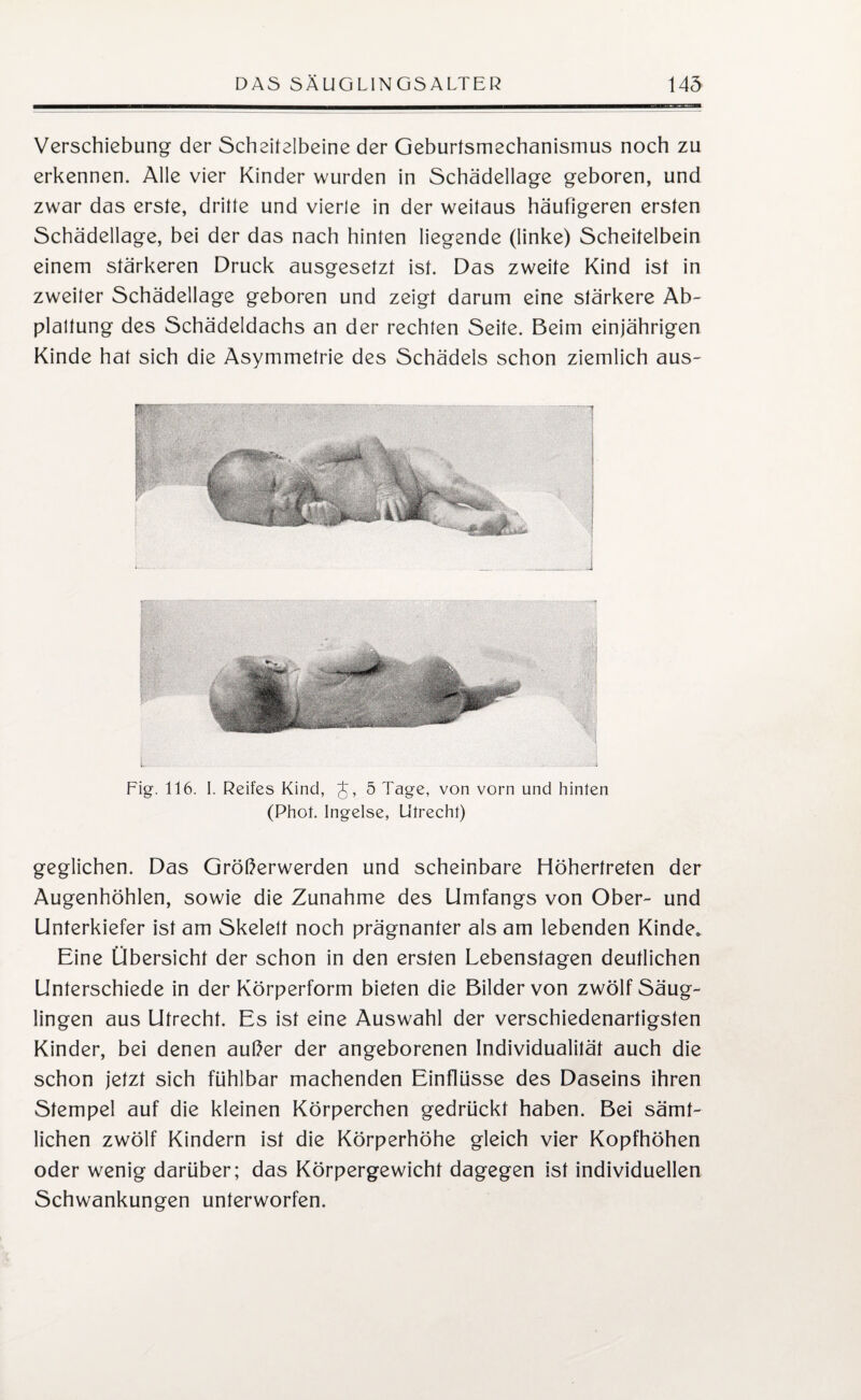 Verschiebung der Scheitelbeine der Geburtsmechanismus noch zu erkennen. Alle vier Kinder wurden in Schädellage geboren, und zwar das erste, dritte und vierle in der weitaus häufigeren ersten Schädellage, bei der das nach hinten liegende (linke) Scheitelbein einem stärkeren Druck ausgesetzt ist. Das zweite Kind ist in zweiter Schädellage geboren und zeigt darum eine stärkere Ab¬ plattung des Schädeldachs an der rechten Seite. Beim einjährigen Kinde hat sich die Asymmetrie des Schädels schon ziemlich aus- Fig. 116. I. Reifes Kind, J, 5 Tage, von vorn und hinten (Phot. Ingelse, Utrecht) geglichen. Das Größerwerden und scheinbare Höhertreten der Augenhöhlen, sowie die Zunahme des Umfangs von Ober- und Unterkiefer ist am Skelett noch prägnanter als am lebenden Kinde. Eine Übersicht der schon in den ersten Lebenstagen deutlichen Unterschiede in der Körperform bieten die Bilder von zwölf Säug¬ lingen aus Utrecht. Es ist eine Auswahl der verschiedenartigsten Kinder, bei denen außer der angeborenen Individualität auch die schon jetzt sich fühlbar machenden Einflüsse des Daseins ihren Stempel auf die kleinen Körperchen gedrückt haben. Bei sämt¬ lichen zwölf Kindern ist die Körperhöhe gleich vier Kopfhöhen oder wenig darüber; das Körpergewicht dagegen ist individuellen Schwankungen unterworfen.
