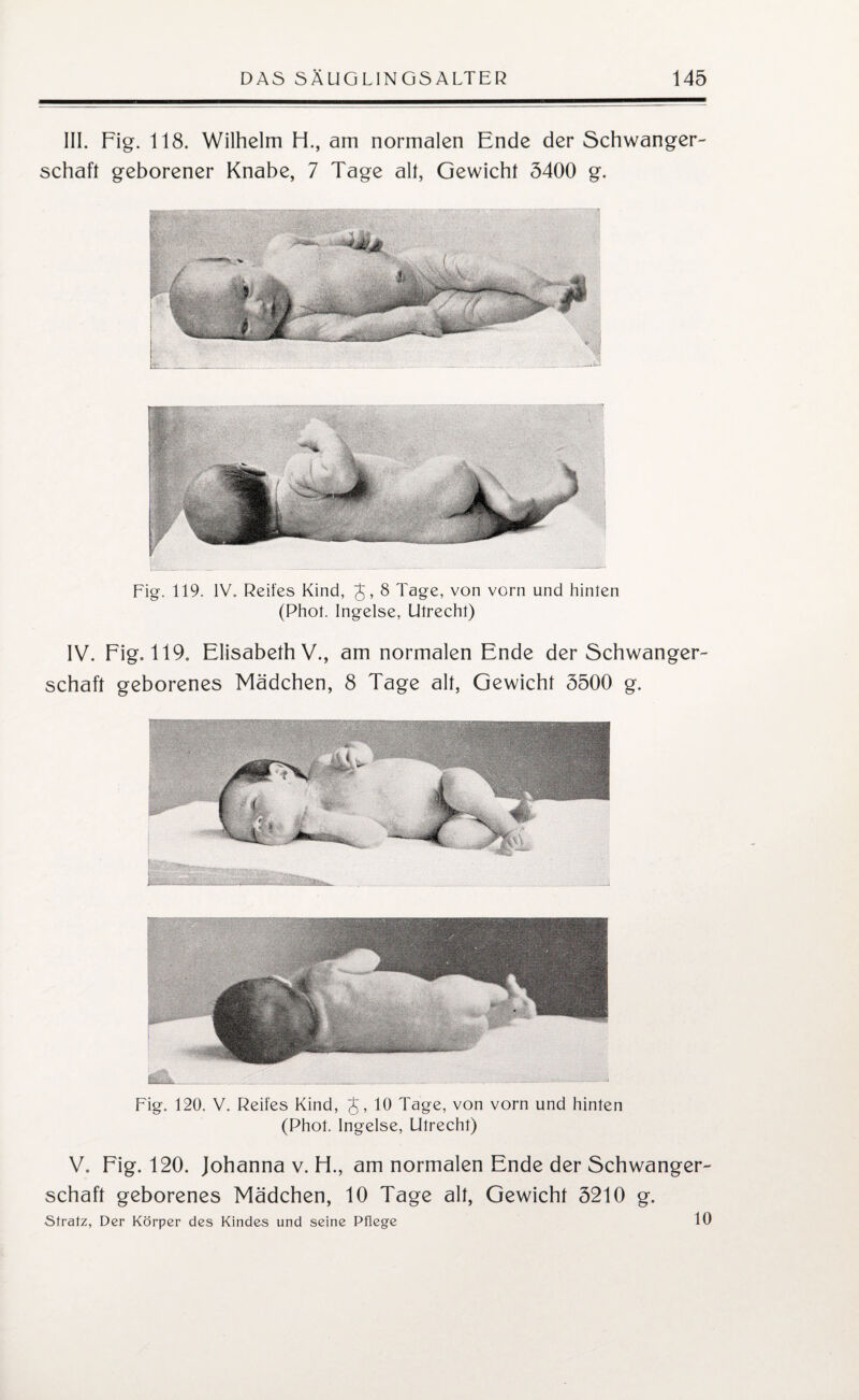 III. Fig. 118. Wilhelm H., am normalen Ende der Schwanger¬ schaft geborener Knabe, 7 Tage all, Gewicht 3400 g. Fig. 119. IV. Reifes Kind, £, 8 Tage, von vorn und hinten (Phot. Ingelse, Utrecht) IV. Fig. 119. Elisabeth V., am normalen Ende der Schwanger¬ schaft geborenes Mädchen, 8 Tage alt, Gewicht 5500 g. Fig. 120. V. Reifes Kind, J, 10 Tage, von vorn und hinten (Phot. Ingelse, Utrecht) V. Fig. 120. Johanna v. H., am normalen Ende der Schwanger¬ schaft geborenes Mädchen, 10 Tage alt, Gewicht 3210 g. Stratz, Der Körper des Kindes und seine Pflege 10