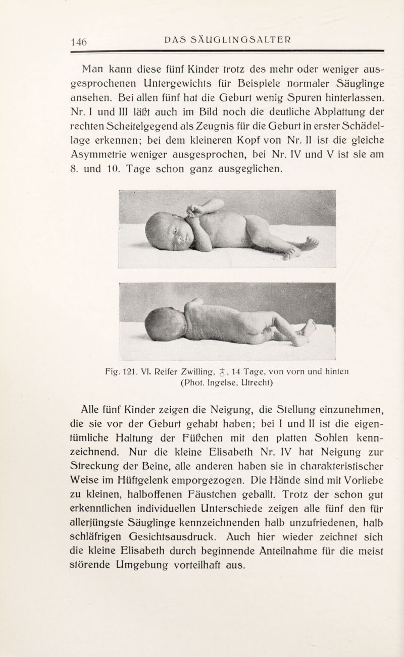 Man kann diese fünf Kinder trotz des mehr oder weniger aus¬ gesprochenen Untergewichts für Beispiele normaler Säuglinge ansehen. Bei allen fünf hat die Geburt wenig Spuren hinterlassen. Nr. 1 und III läßt auch im Bild noch die deutliche Abplattung der rechten Scheitelgegend als Zeugnis für die Geburt in erster Schädel¬ lage erkennen; bei dem kleineren Kopf von Nr. II ist die gleiche Asymmetrie weniger ausgesprochen, bei Nr. IV und V ist sie am 8. und 10. Tage schon ganz ausgeglichen. Fig. 121. VI. Reifer Zwilling, J, 14 Tage, von vorn und hinten (Phot. Ingelse, Utrecht) Alle fünf Kinder zeigen die Neigung, die Stellung einzunehmen, die sie vor der Geburt gehabt haben; bei I und II ist die eigen¬ tümliche Haltung der Füßchen mit den platten Sohlen kenn¬ zeichnend. Nur die kleine Elisabeth Nr. IV hat Neigung zur Streckung der Beine, alle anderen haben sie in charakteristischer Weise im Hüftgelenk emporgezogen. Die Hände sind mit Vorliebe zu kleinen, halboffenen Fäustchen geballt. Trotz der schon gut erkenntlichen individuellen Unterschiede zeigen alle fünf den für allerjüngste Säuglinge kennzeichnenden halb unzufriedenen, halb schläfrigen Gesichtsausdruck. Auch hier wieder zeichnet sich die kleine Elisabeth durch beginnende Anteilnahme für die meist störende Umgebung vorteilhaft aus.