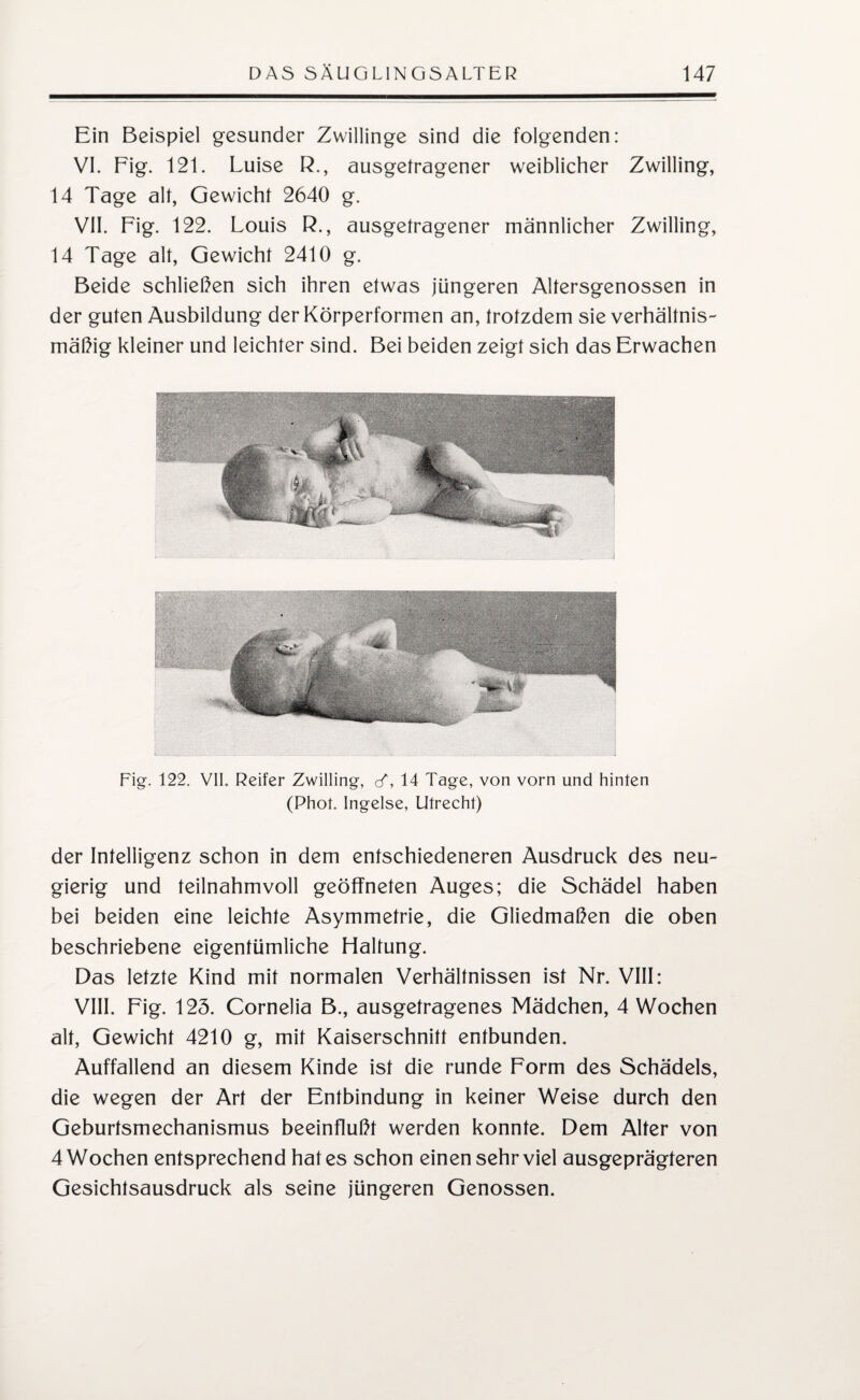 Ein Beispiel gesunder Zwillinge sind die folgenden: VI. Fig. 121. Luise R., ausgetragener weiblicher Zwilling, 14 Tage alt, Gewicht 2640 g. VII. Fig. 122. Louis R., ausgetragener männlicher Zwilling, 14 Tage alt, Gewicht 2410 g. Beide schließen sich ihren etwas jüngeren Altersgenossen in der guten Ausbildung der Körperformen an, trotzdem sie verhältnis¬ mäßig kleiner und leichter sind. Bei beiden zeigt sich das Erwachen Fig. 122. VII. Reifer Zwilling, cf, 14 Tage, von vorn und hinten (Phot. Ingelse, Utrecht) der Intelligenz schon in dem entschiedeneren Ausdruck des neu¬ gierig und teilnahmvoll geöffneten Auges; die Schädel haben bei beiden eine leichte Asymmetrie, die Gliedmaßen die oben beschriebene eigentümliche Haltung. Das letzte Kind mit normalen Verhältnissen ist Nr. VIII: VIII. Fig. 123. Cornelia B., ausgetragenes Mädchen, 4 Wochen alt, Gewicht 4210 g, mit Kaiserschnitt entbunden. Auffallend an diesem Kinde ist die runde Form des Schädels, die wegen der Art der Entbindung in keiner Weise durch den Geburtsmechanismus beeinflußt werden konnte. Dem Alter von 4 Wochen entsprechend hat es schon einen sehr viel ausgeprägteren Gesichtsausdruck als seine jüngeren Genossen.
