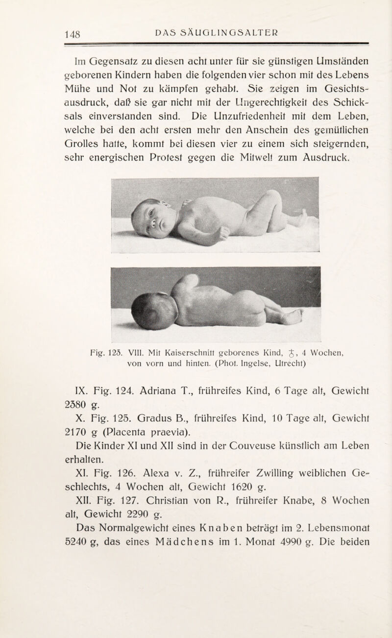 Im Gegensatz zu diesen acht unter für sie günstigen Umständen geborenen Kindern haben die folgenden vier schon mit des Lebens Mühe und Not zu kämpfen gehabt. Sie zeigen im Gesichts¬ ausdruck, daß sie gar nicht mit der Ungerechtigkeit des Schick¬ sals einverstanden sind. Die Unzufriedenheit mit dem Leben, welche bei den acht ersten mehr den Anschein des gemütlichen Grolles halte, kommt bei diesen vier zu einem sich steigernden, sehr energischen Protest gegen die Mitwelt zum Ausdruck. Fig. 125. VIII. Mit Kaiserschnitt geborenes Kind, J, 4 Wochen, von vorn und hinten. (Phot. Ingelse, Utrecht) IX. Fig. 124. Adriana T., frühreifes Kind, 6 Tage alt, Gewicht 2580 g. X. Fig. 125. Gradus B., frühreifes Kind, 10 Tage alt, Gewicht 2170 g (Placenta praevia). Die Kinder XI und XII sind in der Couveuse künstlich am Leben erhalten. XI. Fig. 126. Alexa v. Z., frühreifer Zwilling weiblichen Ge¬ schlechts, 4 Wochen alt, Gewicht 1620 g. XII. Fig. 127. Christian von R., frühreifer Knabe, 8 Wochen alt, Gewicht 2290 g. Das Normalgewicht eines Knaben beträgt im 2. Lebensmonat 5240 g, das eines Mädchens im 1. Monat 4990 g. Die beiden