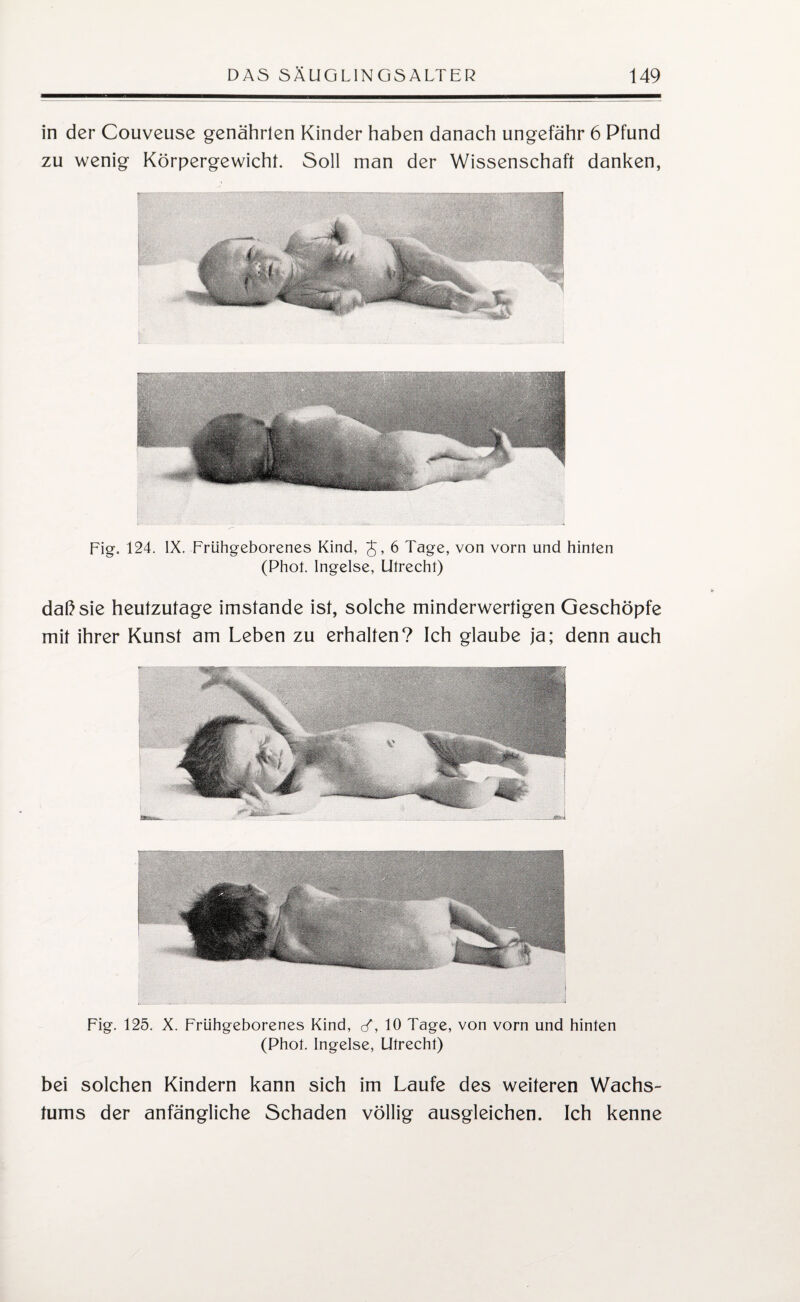 in der Couveuse genährten Kinder haben danach ungefähr 6 Pfund zu wenig Körpergewicht. Soll man der Wissenschaft danken, Fig. 124. IX. Frühgeborenes Kind, J, 6 Tage, von vorn und hinten (Phot. Ingelse, Utrecht) daß sie heutzutage imstande ist, solche minderwertigen Geschöpfe mit ihrer Kunst am Leben zu erhalten? Ich glaube ja; denn auch Fig. 125. X. Frühgeborenes Kind, </, 10 Tage, von vorn und hinten (Phot. Ingelse, Utrecht) bei solchen Kindern kann sich im Laufe des weiteren Wachs¬ tums der anfängliche Schaden völlig ausgleichen. Ich kenne