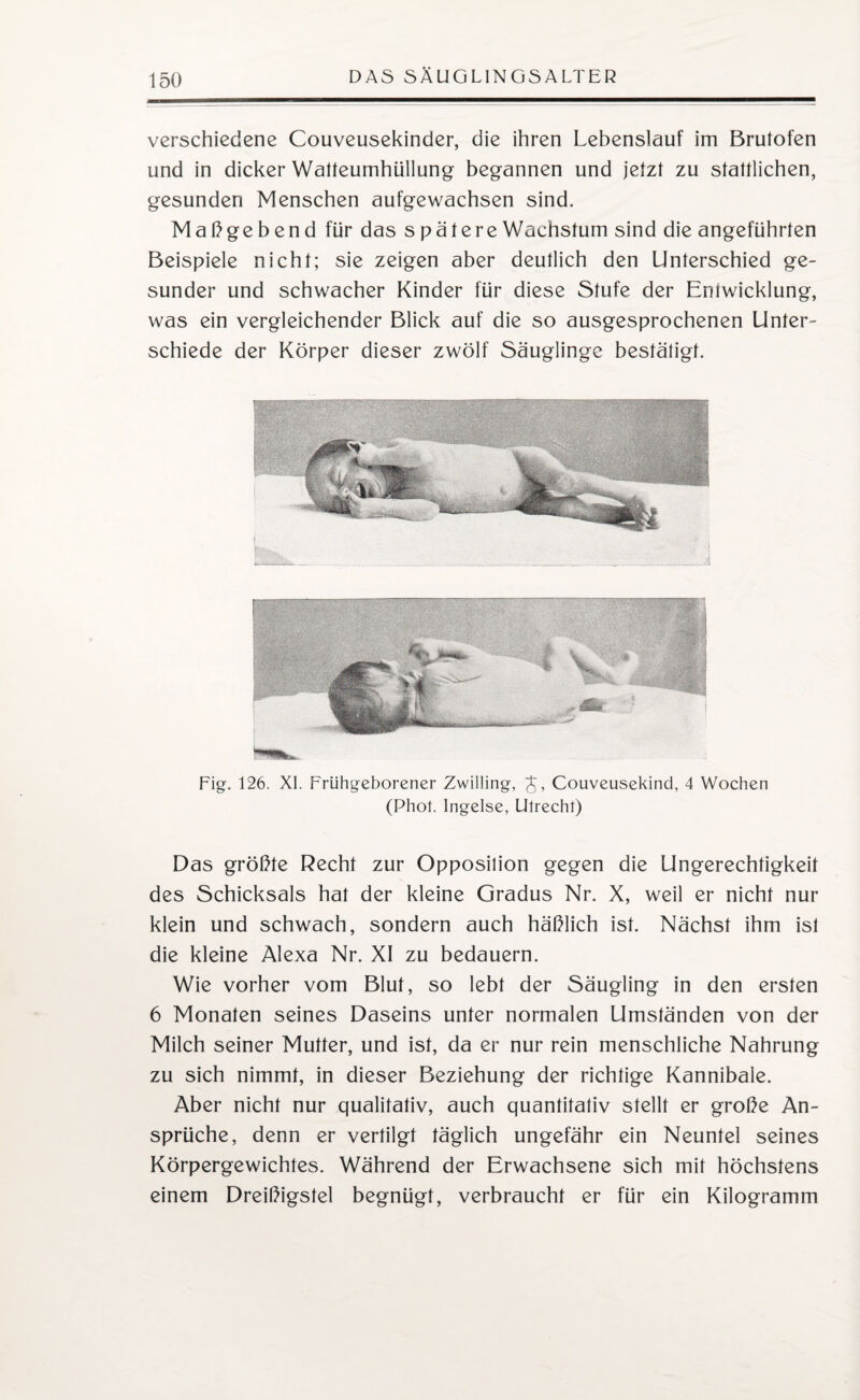 verschiedene Couveusekinder, die ihren Lebenslauf im Brutofen und in dicker Watteumhüllung begannen und jetzt zu stattlichen, gesunden Menschen aufgewachsen sind. Maßgebend für das spätere Wachstum sind die angeführten Beispiele nicht; sie zeigen aber deutlich den Unterschied ge¬ sunder und schwacher Kinder für diese Stufe der Entwicklung, was ein vergleichender Blick auf die so ausgesprochenen Unter¬ schiede der Körper dieser zwölf Säuglinge bestätigt. Fig. 126. XI. Frühgeborener Zwilling, Couveusekind, 4 Wochen (Phot. Ingelse, Utrecht) Das größte Recht zur Opposition gegen die Ungerechtigkeit des Schicksals hat der kleine Gradus Nr. X, weil er nicht nur klein und schwach, sondern auch häßlich ist. Nächst ihm ist die kleine Alexa Nr. XI zu bedauern. Wie vorher vom Blut, so lebt der Säugling in den ersten 6 Monaten seines Daseins unter normalen Umständen von der Milch seiner Mutter, und ist, da er nur rein menschliche Nahrung zu sich nimmt, in dieser Beziehung der richtige Kannibale. Aber nicht nur qualitativ, auch quantitativ stellt er große An¬ sprüche, denn er vertilgt täglich ungefähr ein Neuntel seines Körpergewichtes. Während der Erwachsene sich mit höchstens einem Dreißigstel begnügt, verbraucht er für ein Kilogramm