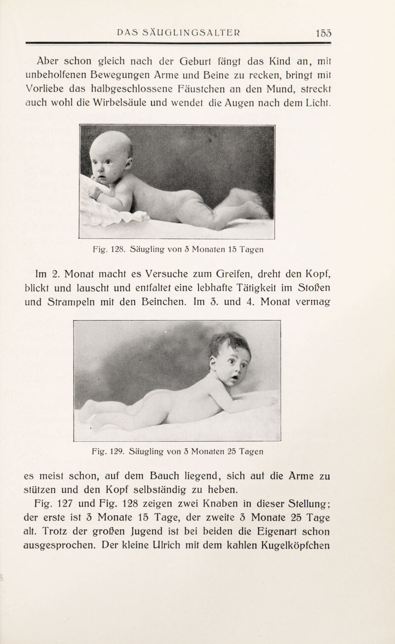 Aber schon gleich nach der Geburt fängt das Kind an, mit unbeholfenen Bewegungen Arme und Beine zu recken, bringt mit Vorliebe das halbgeschlossene Fäustchen an den Mund, streckt auch wohl die Wirbelsäule und wendet die Augen nach dem Licht. Fig. 128. Säugling von 5 Monaten 15 Tagen Im 2. Monat macht es Versuche zum Greifen, dreht den Kopf, blickt und lauscht und entfaltet eine lebhafte Tätigkeit im Stoßen und Strampeln mit den Beinchen. Im 5. und 4. Monat vermag Fig. 129. Säugling von 5 Monaten 25 Tagen es meist schon, auf dem Bauch liegend, sich auf die Arme zu stützen und den Kopf selbständig zu heben. Fig. 127 und Fig. 128 zeigen zwei Knaben in dieser Stellung; der erste ist 5 Monate 15 Tage, der zweite 5 Monate 25 Tage alt. Trotz der großen Jugend ist bei beiden die Eigenart schon ausgesprochen. Der kleine Ulrich mit dem kahlen Kugelköpfchen