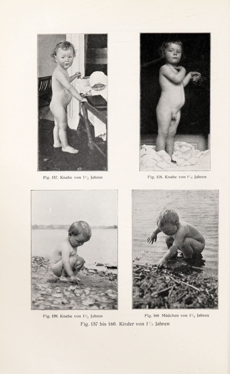 Fig. 159. Knabe von V\2 Jahren Fig. 160 Mädchen von 11|2 Jahren Fig. 157 bis 160. Kinder von 11/a Jahren ill ’J'V I;- ■ ■ fe nRüü)|g