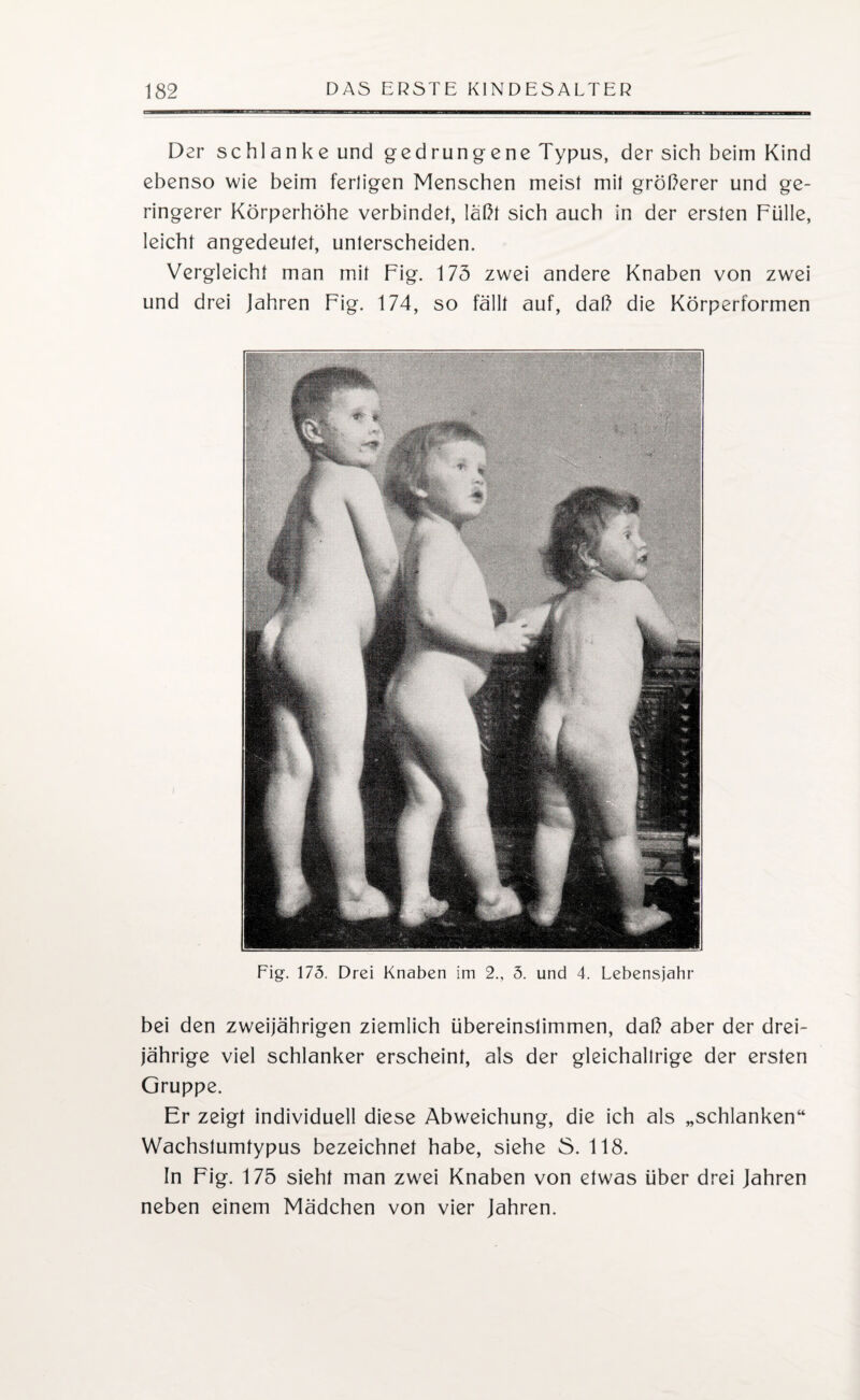 Dar schlanke und gedrungene Typus, der sich beim Kind ebenso wie beim ferligen Menschen meist mit gröberer und ge¬ ringerer Körperhöhe verbindet, labt sich auch in der ersten Fülle, leicht angedeutet, unlerscheiden. Vergleicht man mit Fig. 173 zwei andere Knaben von zwei und drei Jahren Fig. 174, so fällt auf, dab die Körperformen Fig. 175. Drei Knaben im 2., 5. und 4. Lebensjahr bei den zweijährigen ziemlich übereinslimmen, dab aber der drei¬ jährige viel schlanker erscheint, als der gleichaltrige der ersten Gruppe. Er zeigt individuell diese Abweichung, die ich als „schlanken“ Wachstumtypus bezeichnet habe, siehe 8. 118. In Fig. 175 sieht man zwei Knaben von etwas über drei Jahren neben einem Mädchen von vier Jahren.