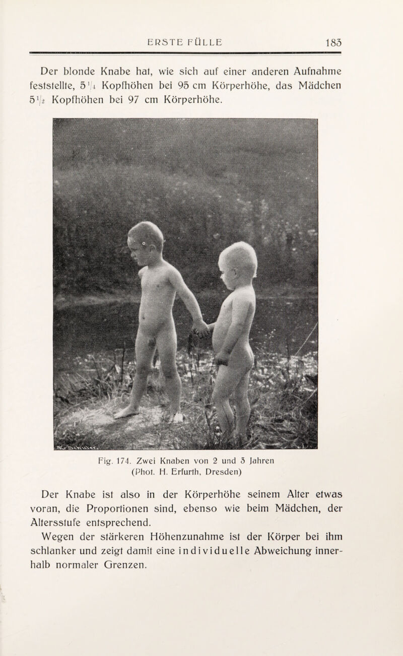 Der blonde Knabe hat, wie sich auf einer anderen Aufnahme feststellte, 5'/± Kopfhöhen bei 95 cm Körperhöhe, das Mädchen 51l-2 Kopfhöhen bei 97 cm Körperhöhe. Fig. 174. Zwei Knaben von 2 und 5 Jahren (Phot. H. Erfurlh, Dresden) Der Knabe ist also in der Körperhöhe seinem Alter etwas voran, die Proportionen sind, ebenso wie beim Mädchen, der Altersstufe entsprechend. Wegen der stärkeren Höhenzunahme ist der Körper bei ihm schlanker und zeigt damit eine individuelle Abweichung inner¬ halb normaler Grenzen.