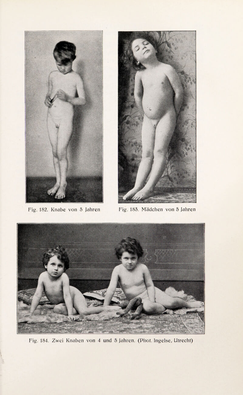 Fig. 184. Zwei Knaben von 4 und 5 Jahren. (Phot. Ingelse, Utrecht)