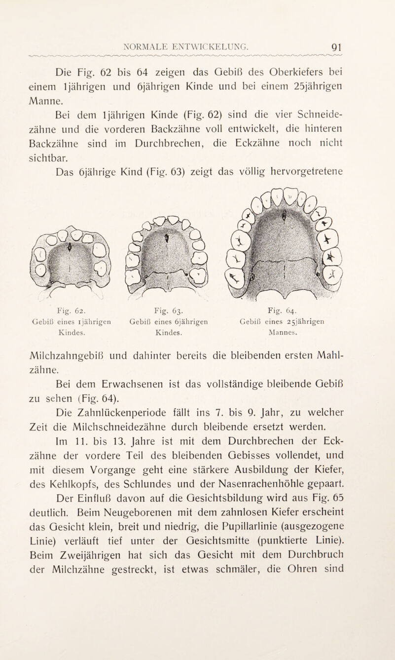 Die Fig. 62 bis 64 zeigen das Gebiß des Oberkiefers bei einem ljährigen und 6jährigen Kinde und bei einem 25jährigen Manne. Bei dem 1jährigen Kinde (Fig. 62) sind die vier Schneide¬ zähne und die vorderen Backzähne voll entwickelt, die hinteren Backzähne sind im Durchbrechen, die Eckzähne noch nicht sichtbar. Das 6jährige Kind (Fig. 63) zeigt das völlig hervorgetretene Fig. 62. Gebiß eines ijährigen Kindes. Fig. 63. Gebiß eines 6jährigen Kindes. Fig. 64. Gebiß eines 25jährigen Mannes. Milchzahngebiß und dahinter bereits die bleibenden ersten Mahl¬ zähne. Bei dem Erwachsenen ist das vollständige bleibende Gebiß zu sehen (Fig. 64). Die Zahnlückenperiode fällt ins 7. bis 9. Jahr, zu welcher Zeit die Milchschneidezähne durch bleibende ersetzt werden. Im 11. bis 13. Jahre ist mit dem Durchbrechen der Eck¬ zähne der vordere Teil des bleibenden Gebisses vollendet, und mit diesem Vorgänge geht eine stärkere Ausbildung der Kiefer, des Kehlkopfs, des Schlundes und der Nasenrachenhöhle gepaart. Der Einfluß davon auf die Gesichtsbildung wird aus Fig. 65 deutlich. Beim Neugeborenen mit dem zahnlosen Kiefer erscheint das Gesicht klein, breit und niedrig, die Pupillarlinie (ausgezogene Linie) verläuft tief unter der Gesichtsmitte (punktierte Linie). Beim Zweijährigen hat sich das Gesicht mit dem Durchbruch der Milchzähne gestreckt, ist etwas schmäler, die Ohren sind