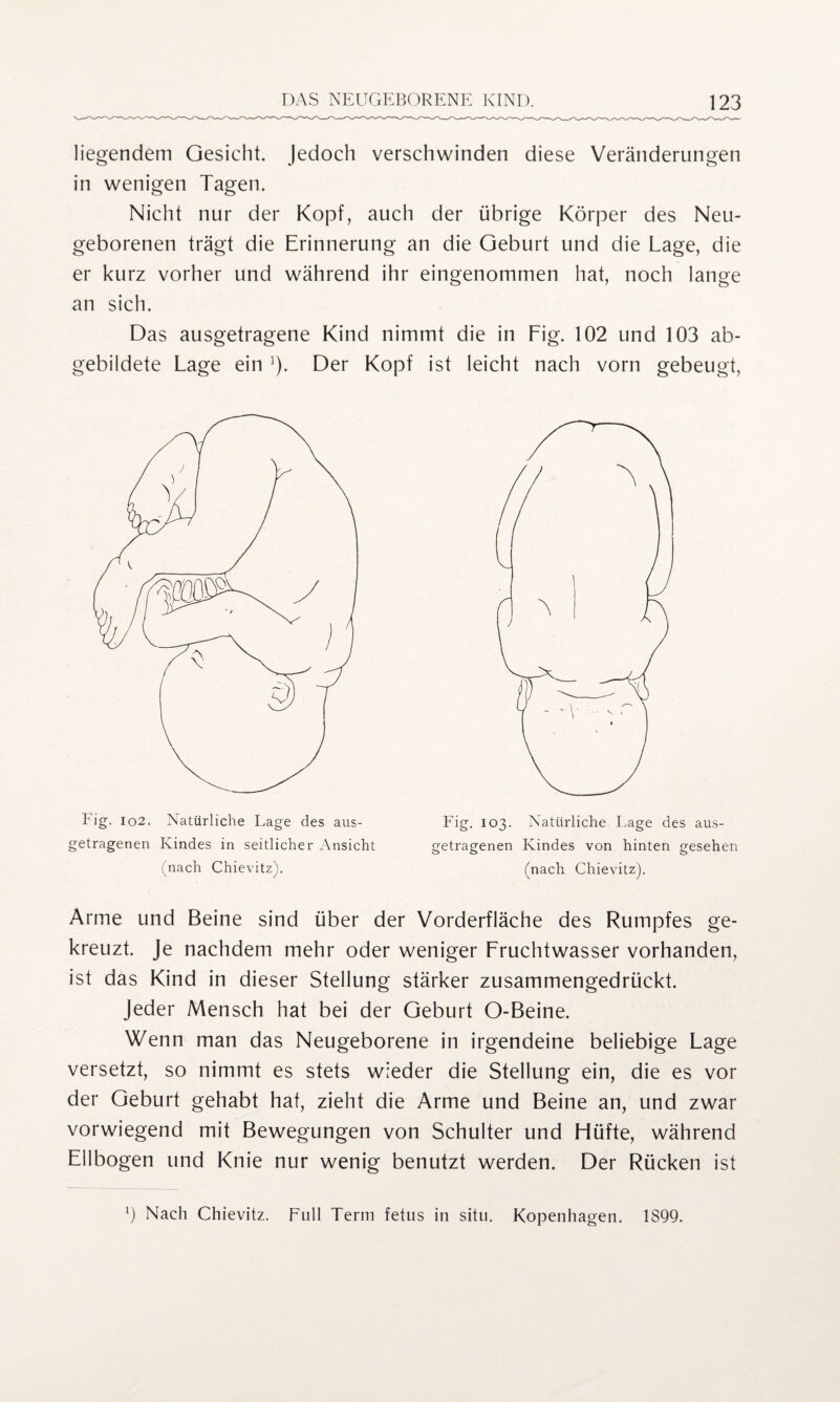 liegendem Gesicht. Jedoch verschwinden diese Veränderungen in wenigen Tagen. Nicht nur der Kopf, auch der übrige Körper des Neu¬ geborenen trägt die Erinnerung an die Geburt und die Lage, die er kurz vorher und während ihr eingenommen hat, noch lange an sich. Das ausgetragene Kind nimmt die in Fig. 102 und 103 ab¬ gebildete Lage ein ]). Der Kopf ist leicht nach vorn gebeugt, Fig. 102. Natürliche Lage des aus¬ getragenen Kindes in seitlicher Ansicht (nach Chievitz). Fig. 103. Natürliche Lage des aus¬ getragenen Kindes von hinten gesehen (nach Chievitz). Arme und Beine sind über der Vorderfläche des Rumpfes ge¬ kreuzt. Je nachdem mehr oder weniger Fruchtwasser vorhanden, ist das Kind in dieser Stellung stärker zusammengedrückt. Jeder Mensch hat bei der Geburt O-Beine. Wenn man das Neugeborene in irgendeine beliebige Lage versetzt, so nimmt es stets wieder die Stellung ein, die es vor der Geburt gehabt hat, zieht die Arme und Beine an, und zwar vorwiegend mit Bewegungen von Schulter und Hüfte, während Ellbogen und Knie nur wenig benutzt werden. Der Rücken ist 0 Nach Chievitz. Full Term fetus in situ. Kopenhagen. 1899.