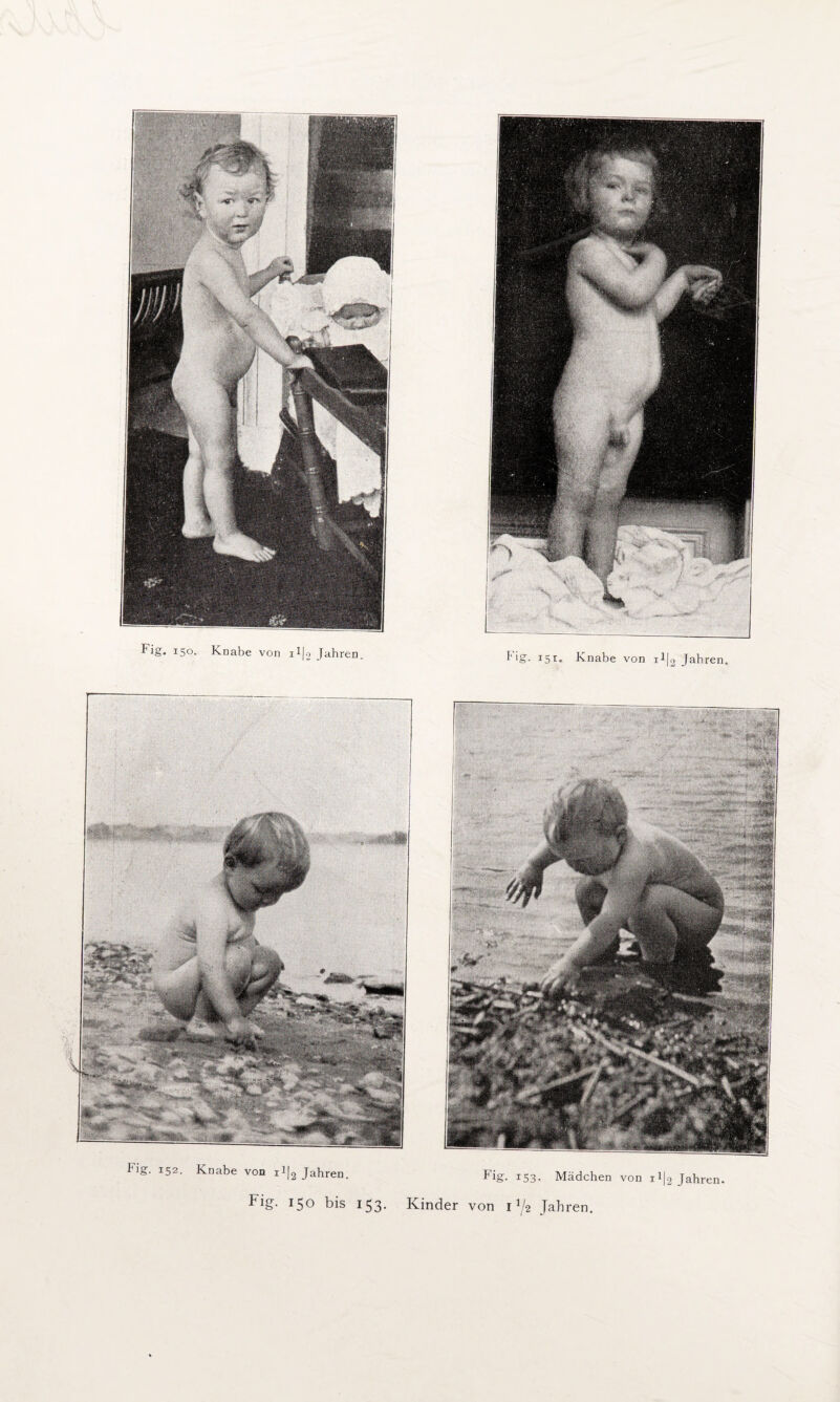 Fig. 15°- Knabe von i^|o Jahren Fig. 15^. Knabe von Jahren Fig. 152. Knabe von 11|2 Jahren. Fig. 150 bis 153. Kinder Fig. 153. Mädchen von 11J2 Jahren, von 1^2 Jahren.