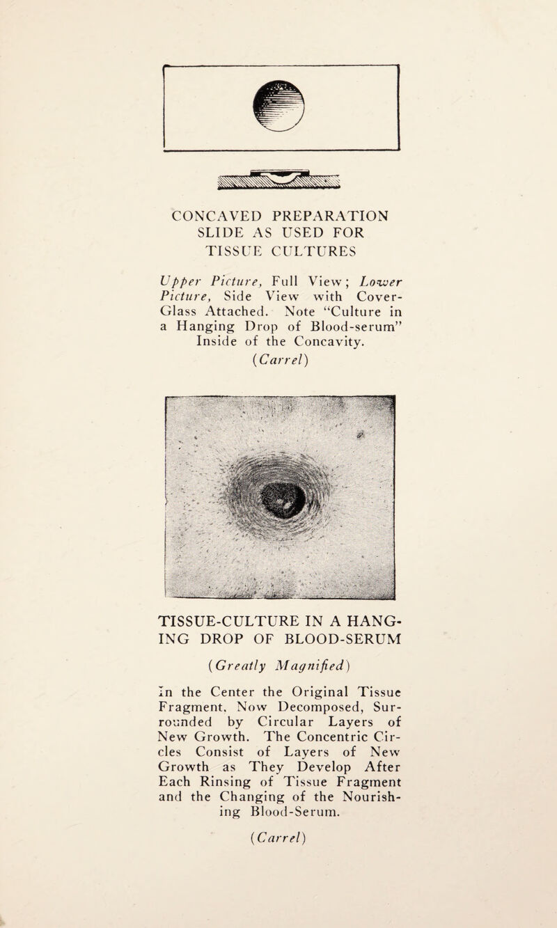 CONCAVED PREPARATION SLIDE AS USED FOR TISSUE CULTURES Upper Picture, Full View; Lo-zver Picture, Side View with Cover- Glass Attached. Note “Culture in a Hanging Drop of Blood-serum” Inside of the Concavity. (Carrel) TISSUE-CULTURE IN A HANG¬ ING DROP OF BLOOD-SERUM (Greatly Magnified) In the Center the Original Tissue Fragment. Now Decomposed, Sur¬ rounded by Circular Layers of New Growth. The Concentric Cir¬ cles Consist of Layers of New Growth as They Develop After Each Rinsing of Tissue Fragment and the Changing of the Nourish¬ ing Blood-Serum. (Carrel)