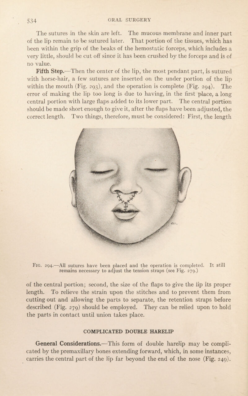 The sutures in the skin are left. The mucous membrane and inner part of the lip remain to be sutured later. That portion of the tissues, which has been within the grip of the beaks of the hemostatic forceps, which includes a very little, should be cut off since it has been crushed by the forceps and is of no value. Fifth Step .—Then the center of the lip, the most pendant part, is sutured with horse-hair, a few sutures are inserted on the under portion of the lip within the mouth (Fig. 293), and the operation is complete (Fig. 294). The error of making the lip too long is due to having, in the first place, a long central portion with large flaps added to its lower part. The central portion should be made short enough to give it, after the flaps have been adjusted, the correct length. Two things, therefore, must be considered: First, the length Fig. 294.—All sutures have been placed and the operation is completed. It still remains necessary to adjust the tension straps (see Fig. 279.) of the central portion; second, the size of the flaps to give the lip its proper length. To relieve the strain upon the stitches and to prevent them from cutting out and allowing the parts to separate, the retention straps before described (Fig. 279) should be employed. They can be relied upon to hold the parts in contact until union takes place. COMPLICATED DOUBLE HARELIP General Considerations.—This form of double harelip may be compli¬ cated by the premaxillary bones extending forward, which, in some instances, carries the central part of the lip far beyond the end of the nose (Fig. 249).