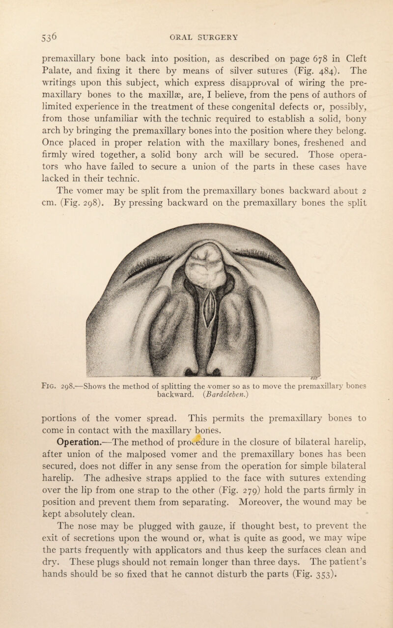 premaxillary bone back into position, as described on page 678 in Cleft Palate, and fixing it there by means of silver sutures (Fig. 484). The writings upon this subject, which express disapproval of wiring the pre¬ maxillary bones to the maxillae, are, I believe, from the pens of authors of limited experience in the treatment of these congenital defects or, possibly, from those unfamiliar with the technic required to establish a solid, bony arch by bringing the premaxillary bones into the position where they belong. Once placed in proper relation with the maxillary bones, freshened and firmly wired together, a solid bony arch will be secured. Those opera¬ tors who have failed to secure a union of the parts in these cases have lacked in their technic. The vomer may be split from the premaxillary bones backward about 2 cm. (Fig. 298). By pressing backward on the premaxillary bones the split Fig. 298.—Shows the method of splitting the vomer so as to move the premaxillary bones backward. (Bardeleben.) portions of the vomer spread. This permits the premaxillary bones to come in contact with the maxillary bones. Operation.—The method of procedure in the closure of bilateral harelip, after union of the malposed vomer and the premaxillary bones has been secured, does not differ in any sense from the operation for simple bilateral harelip. The adhesive straps applied to the face with sutures extending over the lip from one strap to the other (Fig. 279) hold the parts firmly in position and prevent them from separating. Moreover, the wound may be kept absolutely clean. The nose may be plugged with gauze, if thought best, to prevent the exit of secretions upon the wound or, what is quite as good, we may wipe the parts frequently with applicators and thus keep the surfaces clean and dry. These plugs should not remain longer than three days. The patient’s hands should be so fixed that he cannot disturb the parts (Fig. 353).