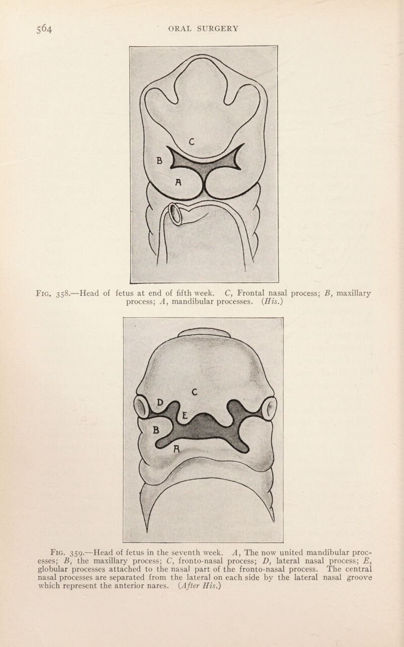 Fig. 358.—Head of fetus at end of fifth week. C, Frontal nasal process; B, maxillary process; A, mandibular processes. (His.) Fig. 359.—Head of fetus in the seventh week. A, The now united mandibular proc¬ esses; B, the maxillary process; C, fronto-nasal process; D, lateral nasal process; E, globular processes attached to the nasal part of the fronto-nasal process. The central nasal processes are separated from the lateral on each side by the lateral nasal groove which represent the anterior nares. (After His.)