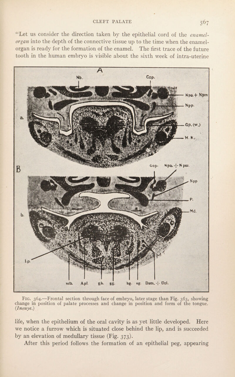 o°7 “Let us consider the direction taken by the epithelial cord of the enamel- organ into the depth of the connective tissue up to the time when the enamel- organ is ready for the formation of the enamel. The first trace of the future tooth in the human embryo is visible about the sixth week of intra-uterine A Mb. Cop* mto. Apt gb* gg. bg. ag. Dam. -j- DoS. Fig. 364.—Frontal section through face of embryo, later stage than Fig. 363, showing change in position of palate processes and change in position and form of the tongue. (Inouye.) life, when the epithelium of the oral cavity is as yet little developed. Here we notice a furrow which is situated close behind the lip, and is succeeded by an elevation of medullary tissue (Fig. 373). After this period follows the formation of an epithelial peg, appearing