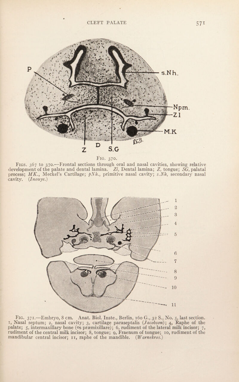 Fig. 371.—Embryo, 8 cm. Anat. Biol. Inste., Berlin, 160 G., 32 S., No. 5, last section. 1, Nasal septum; 2, nasal cavity; 3, cartilage paraseptalis {Jacobson); 4, Raphe of the palate; 5, intermaxillary bone (os prsemixillare); 6, rudiment of the lateral milk incisor; 7, rudiment of the central milk incisor; 8, tongue; 9, Fraenum of tongue; 10, rudiment of the mandibular central incisor; 11, raphe of the mandible. (Warnekros.) m. Fig. 370. Figs. 367 to 370.—Frontal sections through oral and nasal cavities, showing relative development of the palate and dental lamina. Zl, Dental lamina; Z, tongue; SG, palatal process; MK., Meckel’s Cartilage; pNh., primitive nasal cavity; s.Nh, secondary nasal cavity. (Inouye.)