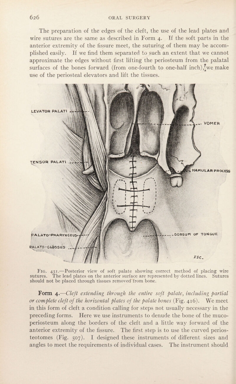 The preparation of the edges of the cleft, the use of the lead plates and wire sutures are the same as described in Form 4. If the soft parts in the anterior extremity of the fissure meet, the suturing of them may be accom¬ plished easily. If we find them separated to such an extent that we cannot approximate the edges without first lifting the periosteum from the palatal surfaces of the bones forward (from one-fourth to one-half inch),\we make use of the periosteal elevators and lift the tissues. Fig. 431.—Posterior view of soft palate showing correct method of placing wire sutures. The lead plates on the anterior surface are represented by dotted lines. Sutures should not be placed through tissues removed from bone. Form 4.—Cleft extending through the entire soft palate, including partial or complete cleft of the horizontal plates of the palate bones (Fig. 416). We meet in this form of cleft a condition calling for steps not usually necessary in the preceding forms. Here we use instruments to denude the bone of the muco- periosteum along the borders of the cleft and a little way forward of the anterior extremity of the fissure. The first step is to use the curved perios- teotomes (Fig. 507). I designed these instruments of different sizes and angles to meet the requirements of individual cases. The instrument should