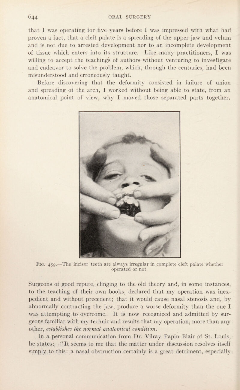 that I was operating for five years before I was impressed with what had proven a fact, that a cleft palate is a spreading of the upper jaw and velum and is not due to arrested development nor to an incomplete development of tissue which enters into its structure. Like many practitioners, I was willing to accept the teachings of authors without venturing to investigate and endeavor to solve the problem, which, through the centuries, had been misunderstood and erroneously taught. Before discovering that the deformity consisted in failure of union and spreading of the arch, I worked without being able to state, from an anatomical point of view, why I moved those separated parts together. Fig. 459.—The incisor teeth are always irregular in complete cleft palate whether operated or not. Surgeons of good repute, clinging to the old theory and, in some instances, to the teaching of their own books, declared that my operation was inex¬ pedient and without precedent; that it would cause nasal stenosis and, by abnormally contracting the jaw, produce a worse deformity than the one I was attempting to overcome. It is now recognized and admitted by sur¬ geons familiar with my technic and results that my operation, more than any other, establishes the normal anatomical condition. In a personal communication from Dr. Vilray Papin Blair of St. Louis, he states; “It seems to me that the matter under discussion resolves itself simply to this: a nasal obstruction certainly is a great detriment, especially