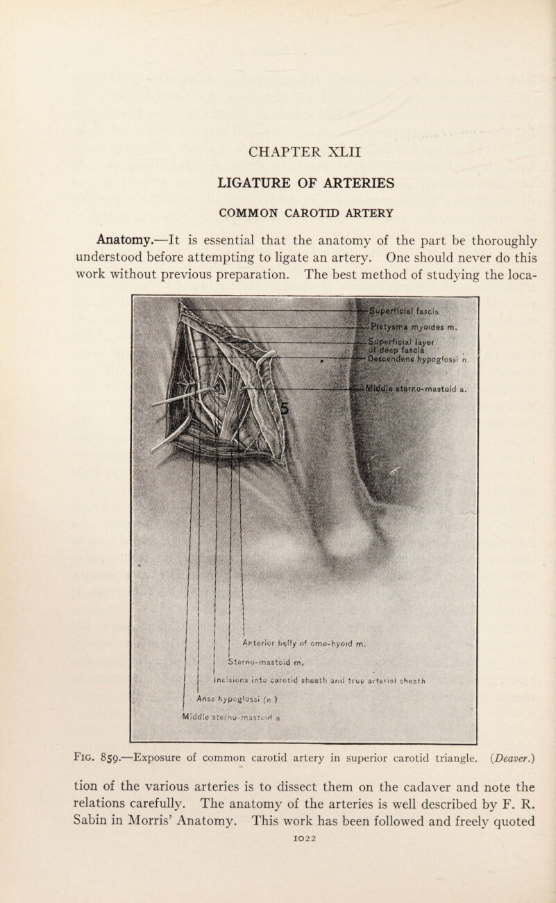 CHAPTER XLII LIGATURE OF ARTERIES COMMON CAROTID ARTERY Anatomy.—It is essential that the anatomy of the part be thoroughly understood before attempting to ligate an artery. One should never do this work without previous preparation. The best method of studying the ioca- Fig. 859.—Exposure of common carotid artery in superior carotid triangle. (Deaver.) tion of the various arteries is to dissect them on the cadaver and note the relations carefully. The anatomy of the arteries is well described by F. R. Sabin in Morris’ Anatomy. This work has been followed and freely quoted interior belly of cmo-hyoid m. , . . no-mastoid rn. sions into Caroli ncisions into carotid sheath and true art«not sheath Arise hypoglossi (n ) M i d d 1 e s t e r n o - rn a si'm d a.