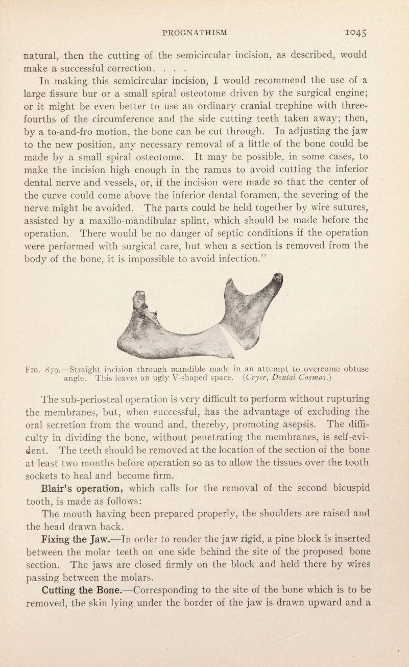 natural, then the cutting of the semicircular incision, as described, would make a successful correction. . . . In making this semicircular incision, I would recommend the use of a large fissure bur or a small spiral osteotome driven by the surgical engine; or it might be even better to use an ordinary cranial trephine with three- fourths of the circumference and the side cutting teeth taken away; then, by a to-and-fro motion, the bone can be cut through. In adjusting the jaw to the new position, any necessary removal of a little of the bone could be made by a small spiral osteotome. It may be possible, in some cases, to make the incision high enough in the ramus to avoid cutting the inferior dental nerve and vessels, or, if the incision were made so that the center of the curve could come above the inferior dental foramen, the severing of the nerve might be avoided. The parts could be held together by wire sutures, assisted by a maxillo-mandibular splint, which should be made before the operation. There would be no danger of septic conditions if the operation were performed with surgical care, but when a section is removed from the body of the bone, it is impossible to avoid infection.” Fig. 879.—Straight incision through mandible made in an attempt to overcome obtuse angle. This leaves an ugly V-shaped space. (Cryer, Dental Cosmos.) 'The sub-periosteal operation is very difficult to perform without rupturing the membranes, but, when successful, has the advantage of excluding the oral secretion from the wound and, thereby, promoting asepsis. The diffi¬ culty in dividing the bone, without penetrating the membranes, is self-evi¬ dent. The teeth should be removed at the location of the section of the bone at least two months before operation so as to allow the tissues over the tooth sockets to heal and become firm. Blair’s operation, which calls for the removal of the second bicuspid tooth, is made as follows: The mouth having been prepared properly, the shoulders are raised and the head drawn back. Fixing the Jaw.—In order to render the jaw rigid, a pine block is inserted between the molar teeth on one side behind the site of the proposed bone section. The jaws are closed firmly on the block and held there by wires passing between the molars. Cutting the Bone.—Corresponding to the site of the bone which is to be removed, the skin lying under the border of the jaw is drawn upward and a