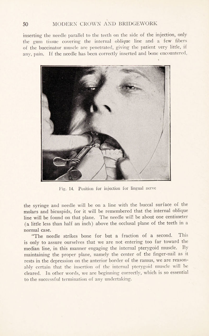 inserting the needle parallel to the teeth on the side of the injection, only the gum tissue covering the internal oblique line and a few fibers of the buccinator muscle are penetrated, giving the patient very little, if any, pain. If the needle has been correctly inserted and bone encountered, Fig. 14. Position for injection for lingual nerve the syringe and needle will be on a line with the buccal surface of the molars and bicuspids, for it will be remembered that the internal oblique line will be found on that plane. The needle will be about one centimeter (a little less than half an inch) above the occlusal plane of the teeth in a normal case. “The needle strikes bone for but a fraction of a second. This is only to assure ourselves that we are not entering too far toward the median line, in this manner engaging the internal pterygoid muscle. By maintaining the proper plane, namely the center of the finger-nail as it rests in the depression on the anterior border of the ramus, we are reason¬ ably certain that the insertion of the internal pterygoid muscle will be cleared. In other words, we are beginning correctly, which is so essential to the successful termination of any undertaking.