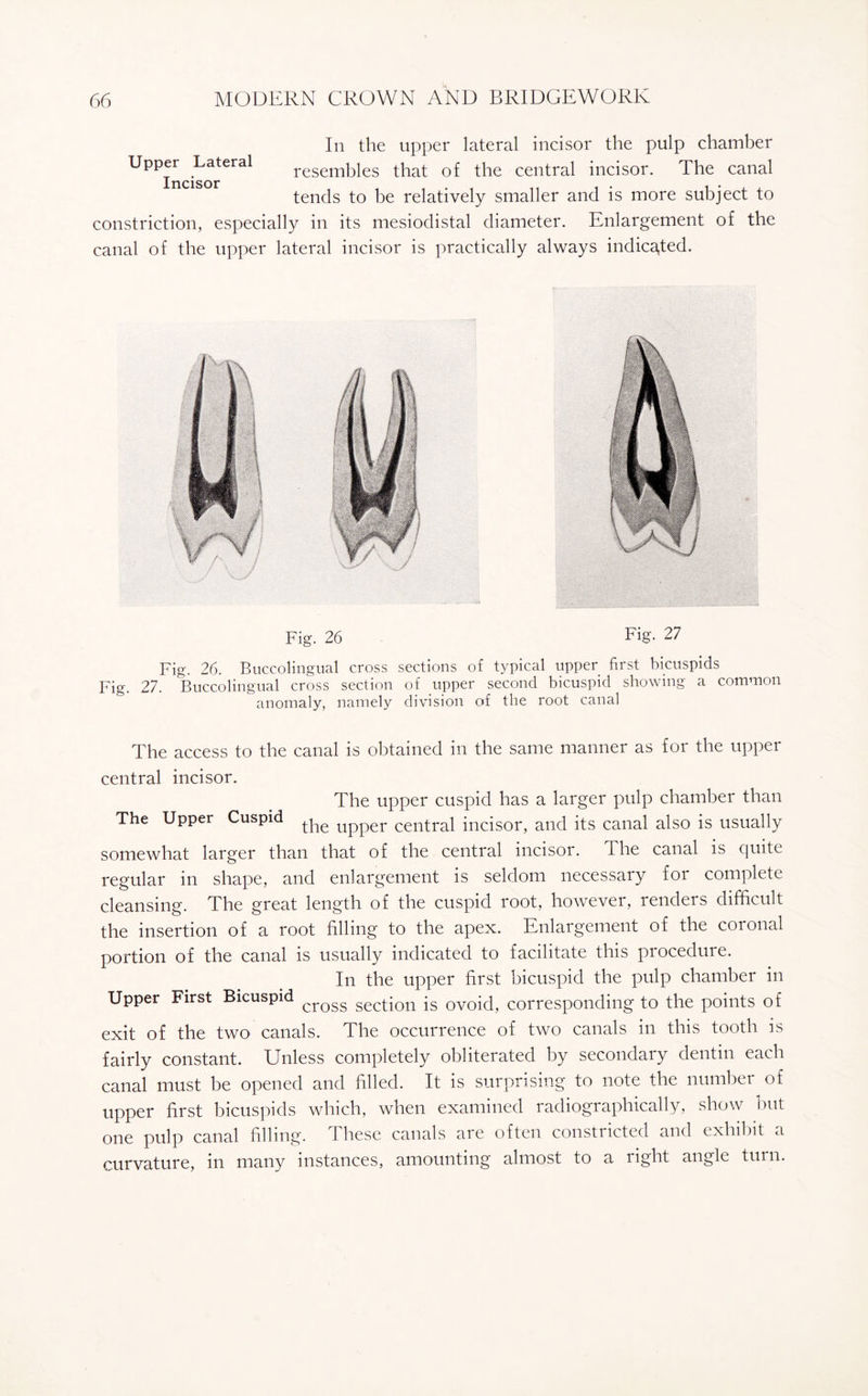 Upper Lateral Incisor In the upper lateral incisor the pulp chamber resembles that of the central incisor. The canal tends to be relatively smaller and is more subject to constriction, especially in its mesiodistal diameter. Enlargement of the canal of the upper lateral incisor is practically always indicated. Fig. 26 Fig. 27 Fig. 26. Buccolingual cross sections of typical upper first bicuspids Fig. 27. Buccolingual cross section of upper second bicuspid showing a common anomaly, namely division of the root canal The access to the canal is obtained in the same manner as for the upper central incisor. The upper cuspid has a larger pulp chamber than The Upper Cuspid Upper central incisor, and its canal also is usually somewhat larger than that of the central incisor. I he canal is quite regular in shape, and enlargement is seldom necessaiy foi complete cleansing. The great length of the cuspid root, however, renders difficult the insertion of a root filling to the apex. Enlargement of the coronal portion of the canal is usually indicated to facilitate this procedure. In the upper first bicuspid the pulp chamber in Upper First Bicuspid cross secti0n is ovoid, corresponding to the points of exit of the two canals. The occurrence of two canals in this tooth is fairly constant. Unless completely obliterated by secondary dentin each canal must be opened and filled. It is surprising to note the number of upper first bicuspids which, when examined radiographically, show out one pulp canal filling. These canals are often constricted and exhibit a curvature, in many instances, amounting almost to a right angle turn.