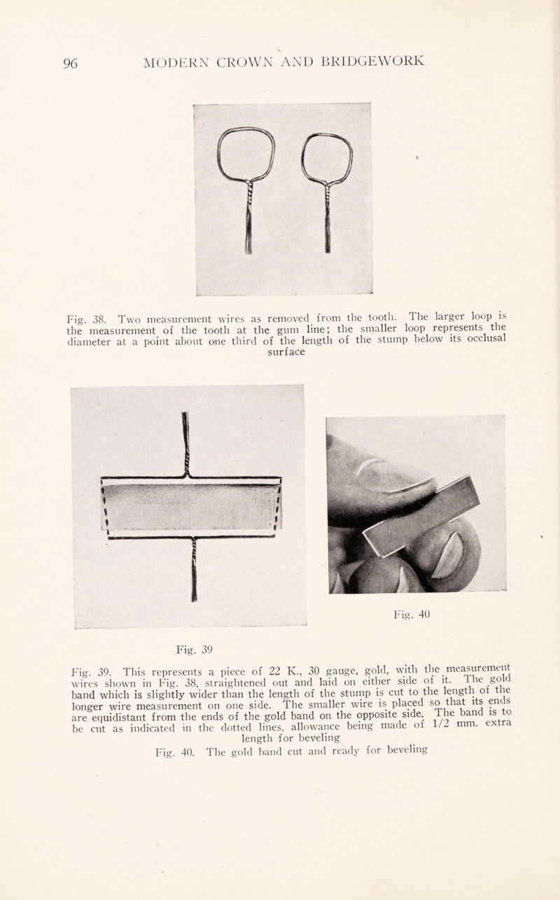 Fig. 38. Two measurement wires as removed from the tooth. The larger loop is the measurement of the tooth at the gum line; the smaller loop represents the diameter at a point about one third of the length of the stump below its occlusal surface Fig. 39 Fig. 39. This represents a piece of 22 K., 30 gauge, gold, with the. measurement wires shown in Fig. 38, straightened out and laid on either side of it. lhe goc band which is slightly wider than the length of the stump is cut to the length o ie longer wire measurement on one side. The smaller wire is placed so that its en s are equidistant from the ends of the gold band on the opposite side i he ban is o be cut as indicated in the dotted lines, allowance being made of 1/- mm. e length for beveling Fig. 40. The gold band cut and ready for beveling