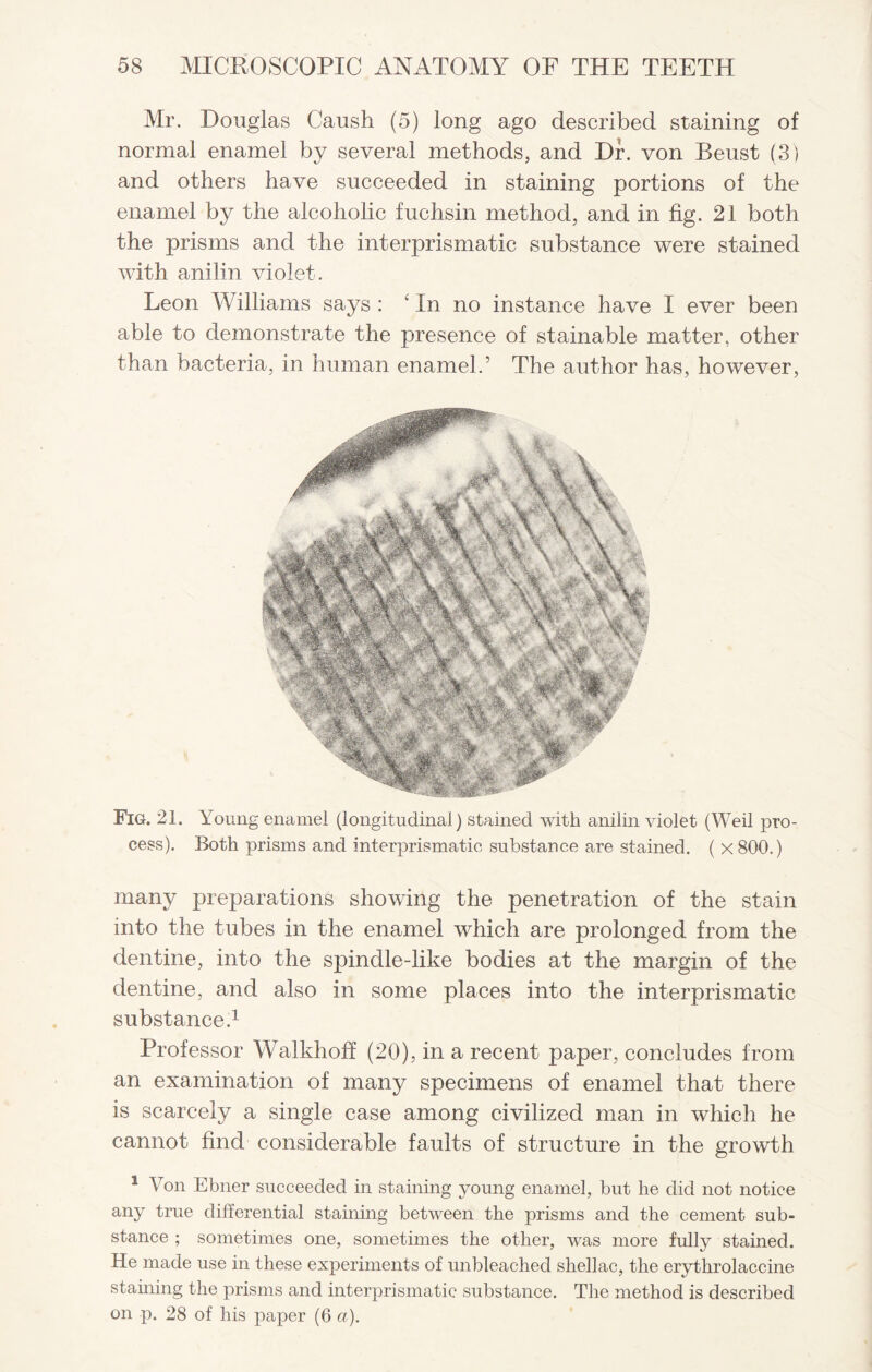 Mr. Douglas Caush (5) long ago described staining of normal enamel by several methods, and Dr. von Beust (3) and others have succeeded in staining portions of the enamel by the alcoholic fuchsin method, and in fig. 21 both the prisms and the interprismatic substance were stained with anilin violet . Leon Williams says : Tn no instance have I ever been able to demonstrate the presence of stainable matter, other than bacteria, in human enamel.’ The author has, however, Fig. 21. Young enamel (longitudinal) stained with anilin violet (Weil pro¬ cess). Both prisms and interprismatic substance are stained. ( x800.) many preparations showing the penetration of the stain into the tubes in the enamel which are prolonged from the dentine, into the spindle-like bodies at the margin of the dentine, and also in some places into the interprismatic substance.1 Professor Walkhoff (20), in a recent paper, concludes from an examination of many specimens of enamel that there is scarcely a single case among civilized man in which he cannot find considerable faults of structure in the growth 1 Von Ebner succeeded in staining young enamel, but he did not notice any true differential staining between the prisms and the cement sub¬ stance ; sometimes one, sometimes the other, was more fully stained. He made use in these experiments of unbleached shellac, the erythrolaccine staining the prisms and interprismatic substance. The method is described on p. 28 of his paper (6 a).