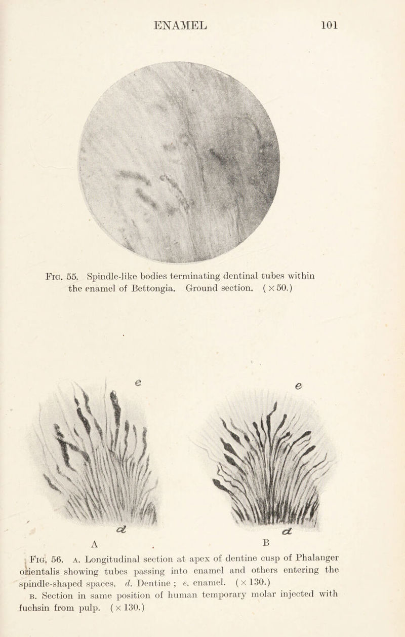 Fig. 55. Spindle-]ike bodies terminating dentinal tubes within the enamel of Bettongia. Ground section. ( X 50.) Fig. 56. a. Longitudinal section at apex of dentine cusp of Phalanger orientalis showing tubes passing into enamel and others entering the spindle-shaped spaces, d. Dentine; e. enamel. (xl30.) b. Section in same position of human temporary molar injected with fuchsin from pulp, (x 130.)