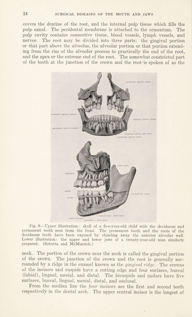 covers the dentine of the root, and the internal pulp tissue which fills the pulp canal. The peridental membrane is attached to the cementum. The pulp cavity contains connective tissue, blood vessels, lymph vessels, and nerves. The root may be divided into three parts: the gingival portion or that part above the alveolus, the alveolar portion or that portion extend¬ ing from the rim of the alveolar process to practically the end of the root, and the apex or the extreme end of the root. The somewhat constricted part of the tooth at the junction of the crown and the root’is spoken of as the > MF permanent superior amine rVfJV , nermanent superior incisors.-- ? W ft, -J M # ' ' permanent inferior, imison-' deciduous inferior canine permanent inferior first mo/nr immanent inferior ednine Fig. 9.—Upper illustration: skull of a five-year-old child with the deciduous and permanent teeth seen from the front. The permanent teeth and the roots of the deciduous teeth have been exposed by chiseling away the anterior alveolar wall. Lower illustration: the upper and lower jaws of a twenty-year-old man similarly prepared. (Sobotta and McMurrich.) neck. The portion of the crown near the neck is called the gingival portion of the crown. The junction of the crown and the root is generally sur¬ rounded by a ridge in the enamel known as the gingival ridge. The crowns of the incisors and cuspids have a cutting edge and four surfaces, buccal (labial), lingual, mesial, and distal. The bicuspids and molars have five surfaces, buccal, lingual, mesial, distal, and occlusal. From the median line the jour incisors are the first and second teeth respectively in the dental arch. The upper central incisor is the longest of