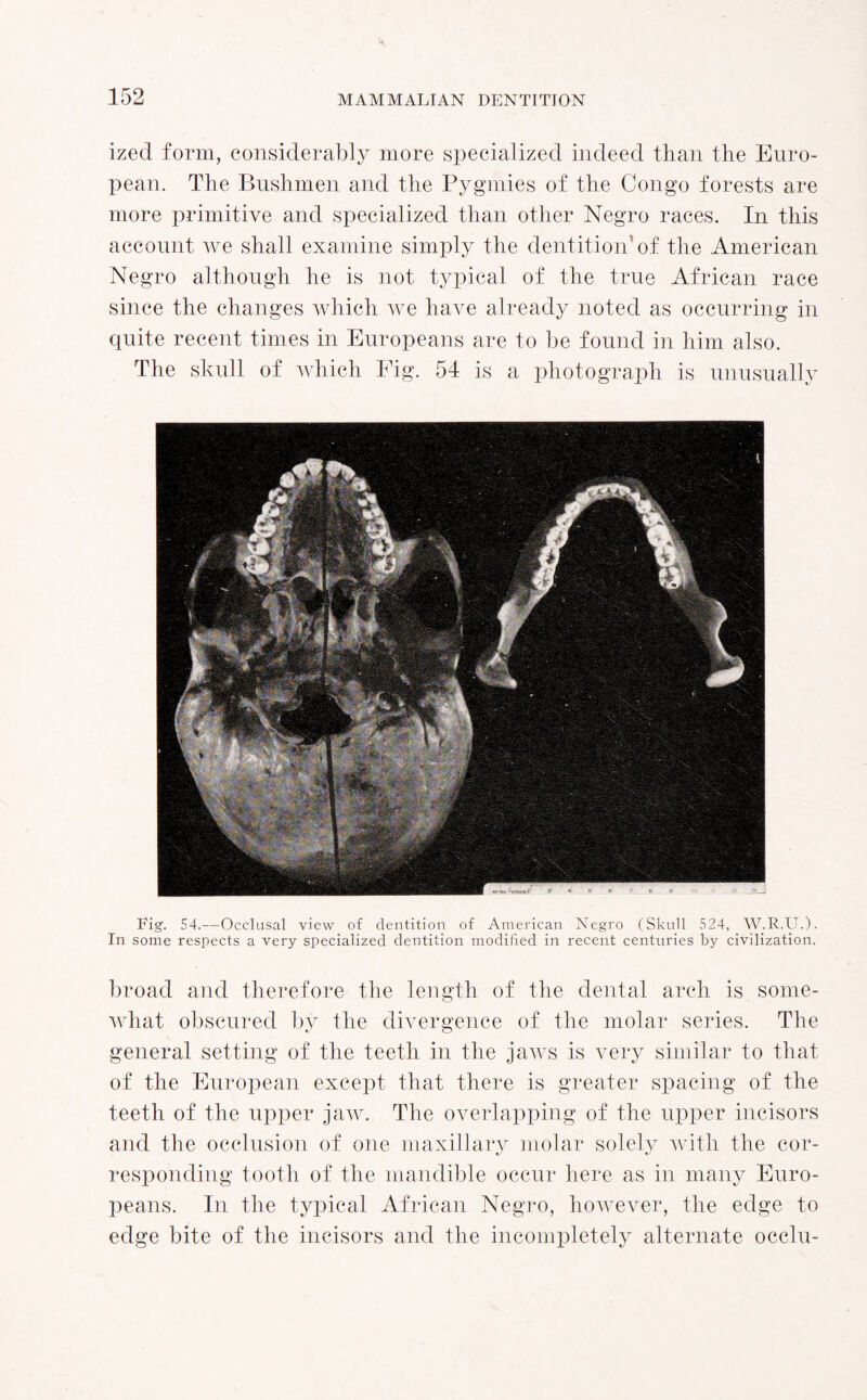 izecl form, considerably more specialized indeed than the Euro¬ pean. The Bushmen and the Pygmies of the Congo forests are more primitive and specialized than other Negro races. In this account we shall examine simply the dentition of the American Negro although he is not typical of the true African race since the changes which we have already noted as occurring in quite recent times in Europeans are to be found in him also. The skull of which Fig. 54 is a photograph is unusually Fig. 54.—Occlusal view of dentition of American Negro (Skull 524, W.R.U.). In some respects a very specialized dentition modified in recent centuries by civilization. broad and therefore the length of the dental arch is some¬ what obscured by the divergence of the molar series. The general setting of the teeth in the jaws is very similar to that of the European except that there is greater spacing of the teeth of the upper jaw. The overlapping of the upper incisors and the occlusion of one maxillary molar solely with the cor¬ responding tooth of the mandible occur here as in many Euro¬ peans. In the typical African Negro, however, the edge to edge bite of the incisors and the incompletely alternate occlu-